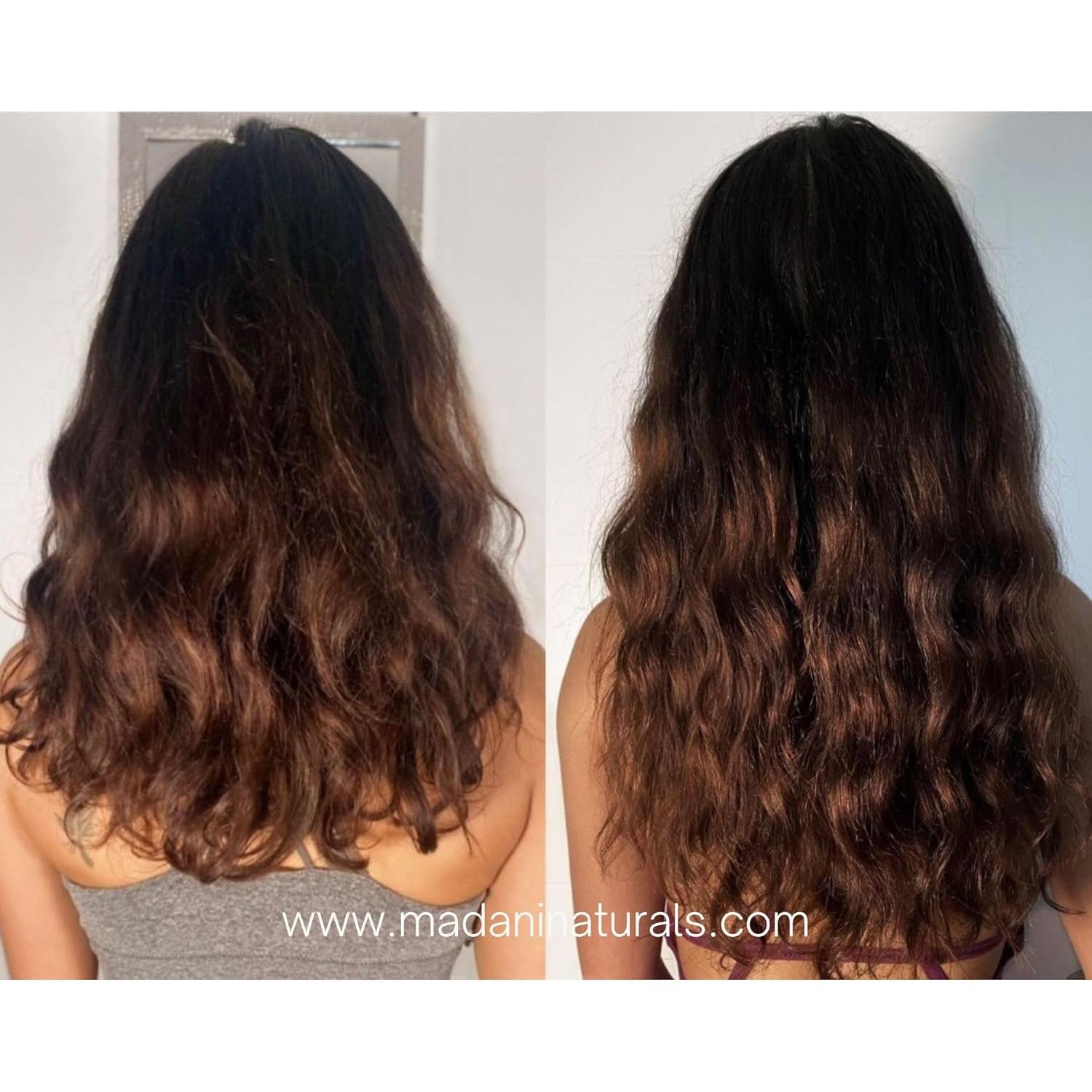 Aceite Estimulador del Crecimiento del Cabello Madani Naturals 59ml