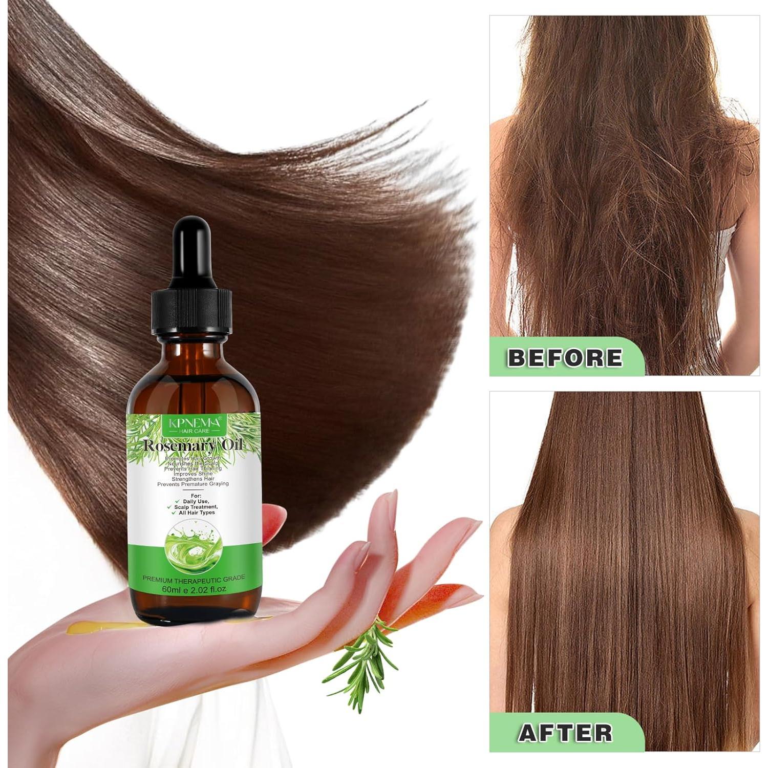 Aceite Esencial de Romero KPNEMA 59.87 ml - Crecimiento Cabello