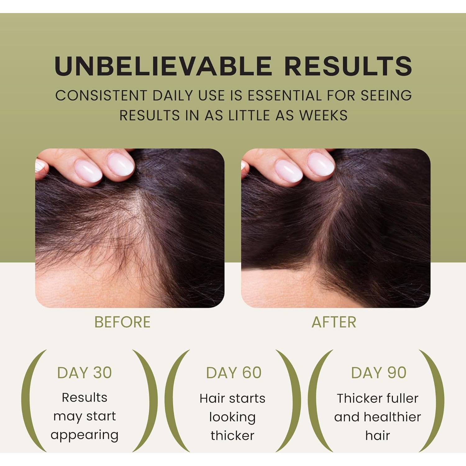 Aceite de Batana Lebanta 100% Puro para Crecimiento del Cabello 140g