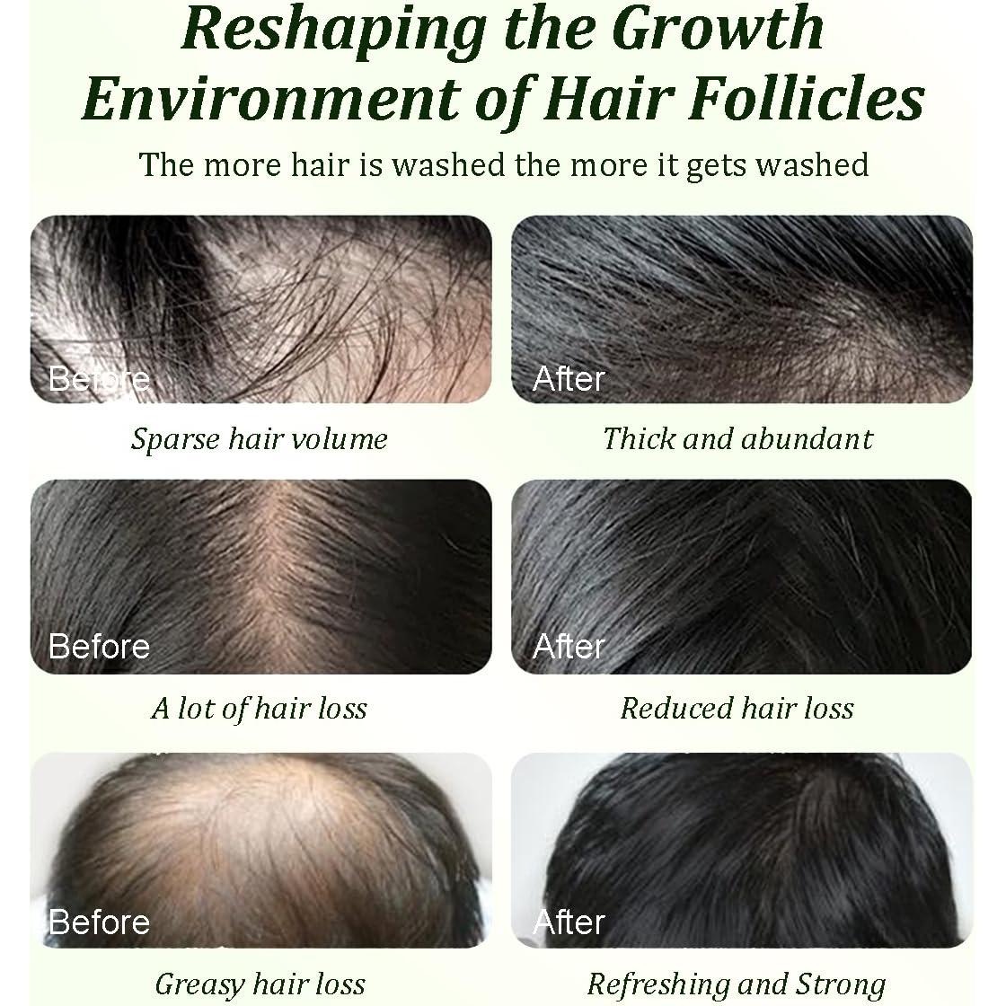 Champú de Aceite de Batana Gypsophila 300 ml - Nutritivo y Suavizante