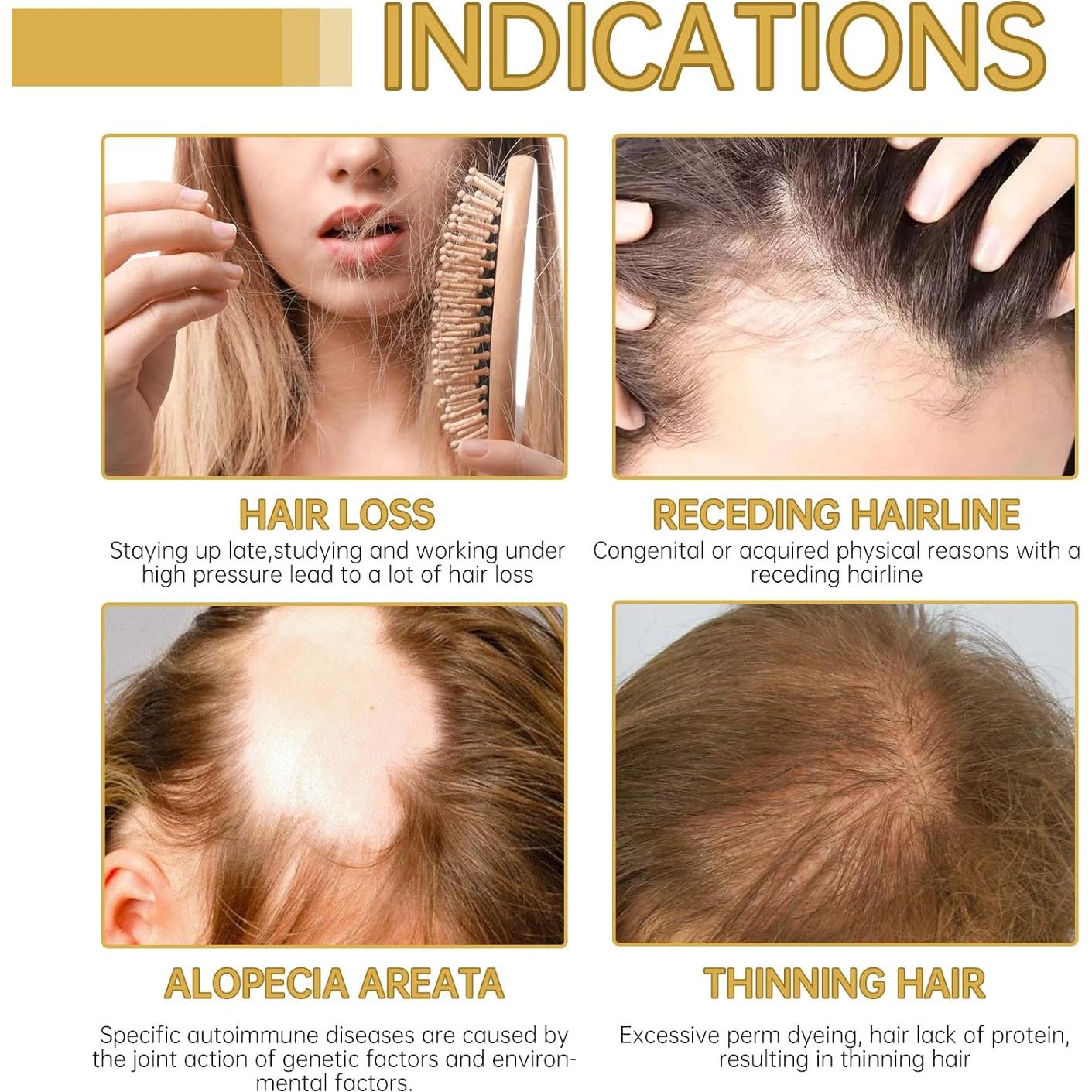 Aceite Vegano Natural Tpyag 60ml para Crecimiento Cabello