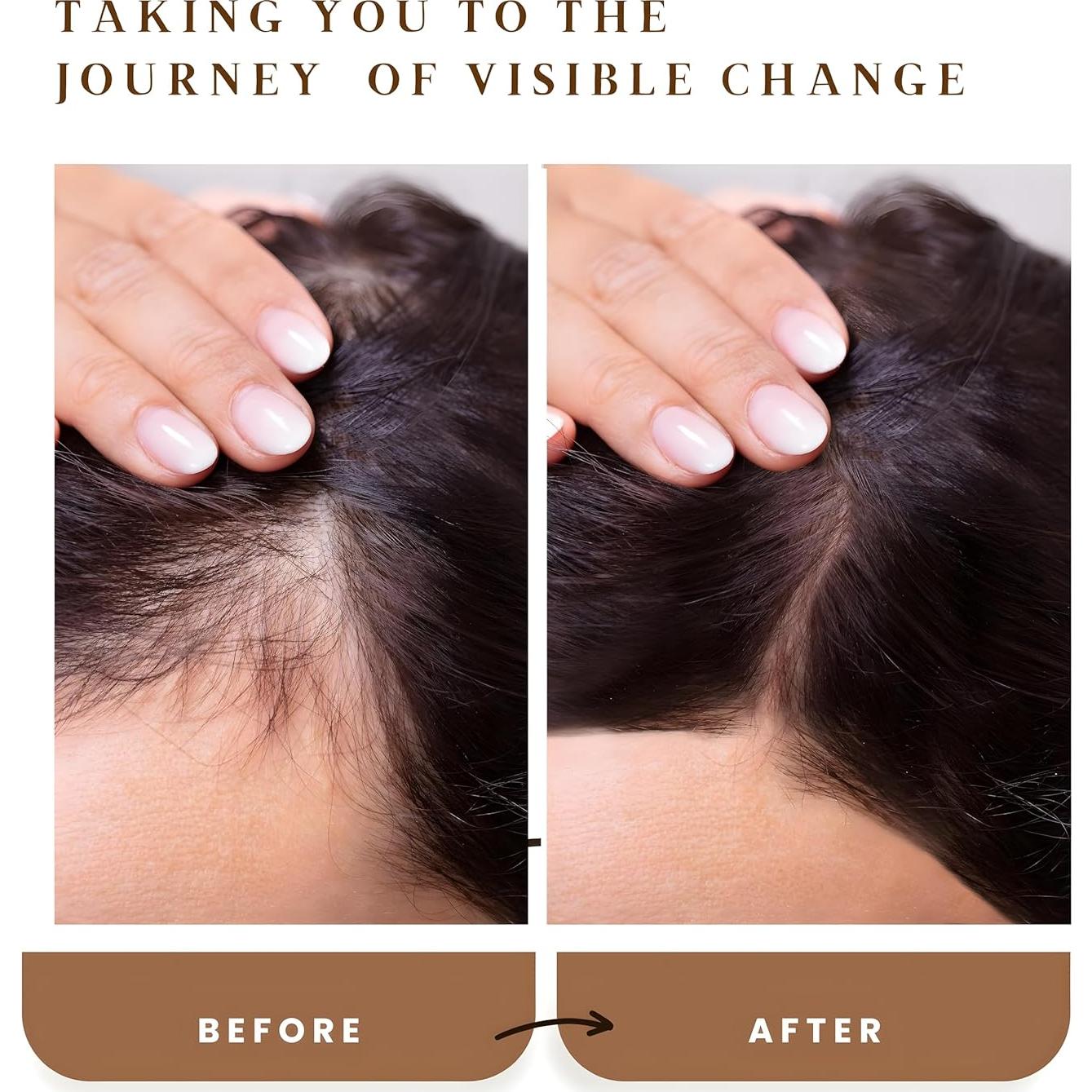 Aceite de Romero The Oily Tonic 48ml - Crecimiento y Regeneración Cabello