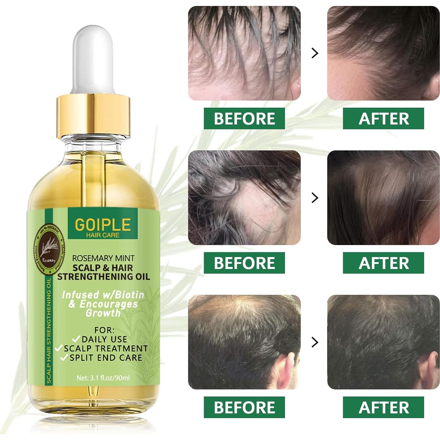 Aceite de Romero Natural WOZUTUNT 91.44 ML para Crecimiento Cabello