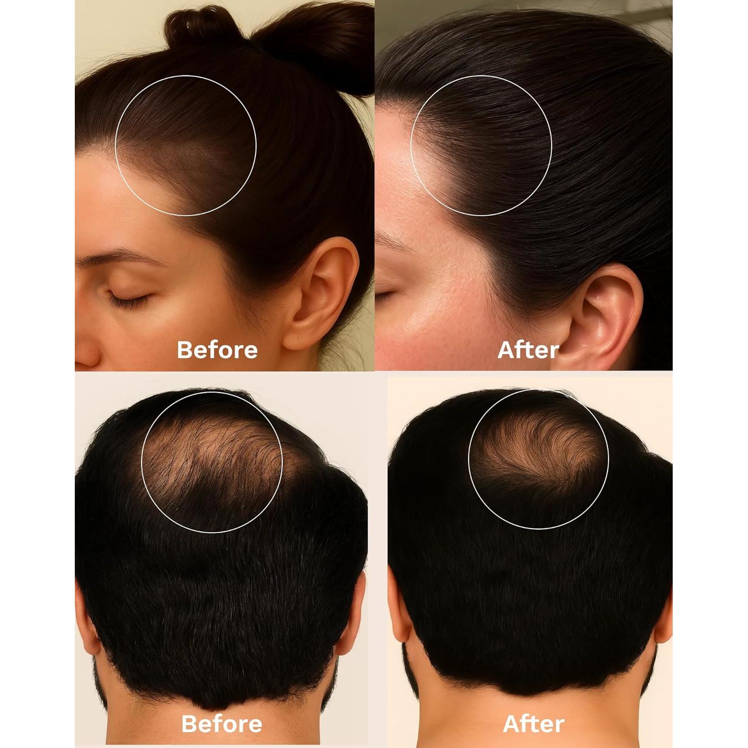 Aceite de Batana Keyoma 30 mL - Crecimiento Cabello con Romero