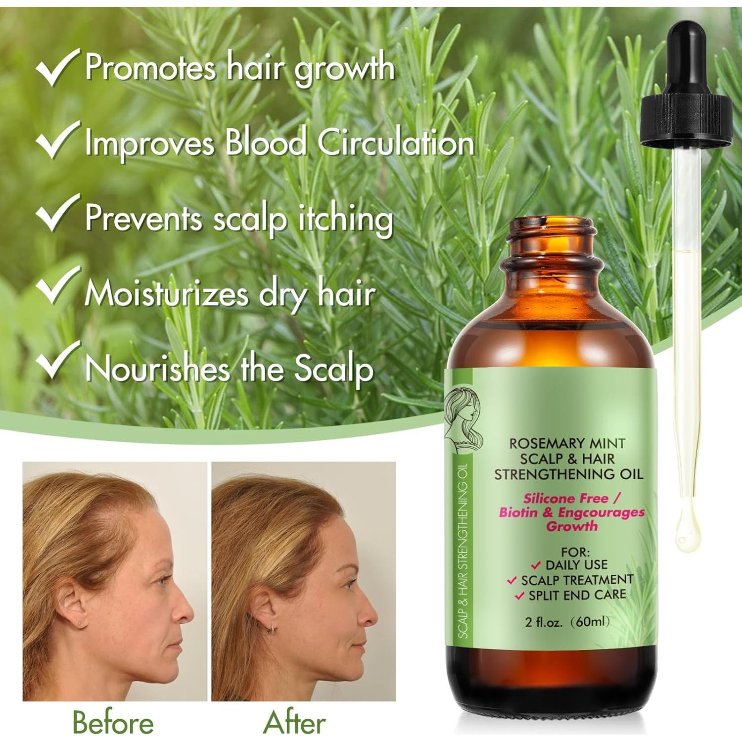 Aceite Esencial de Romero 100% Puro 59.87 ml - Cuidado Cabello