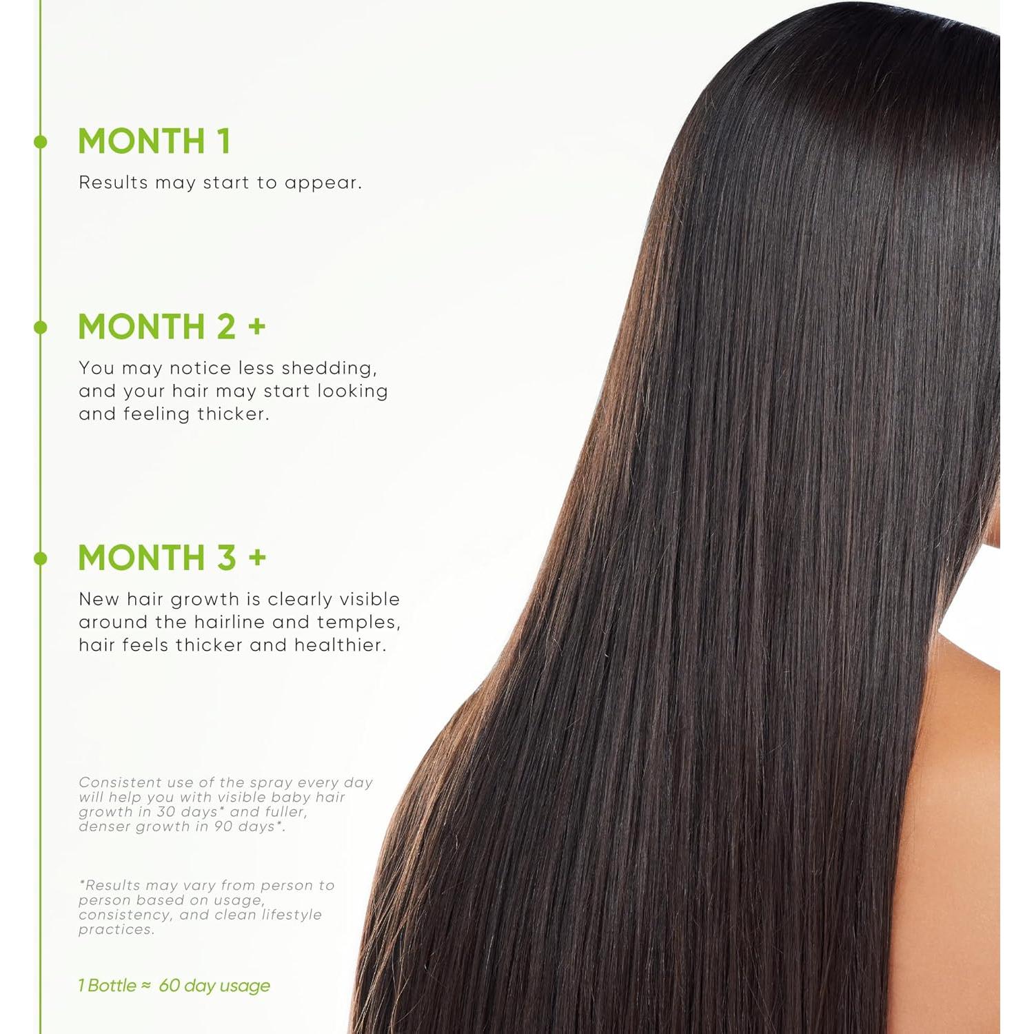 Spray Crecimiento Cabello Svvimer 59.15 ml - Romero y Biotina