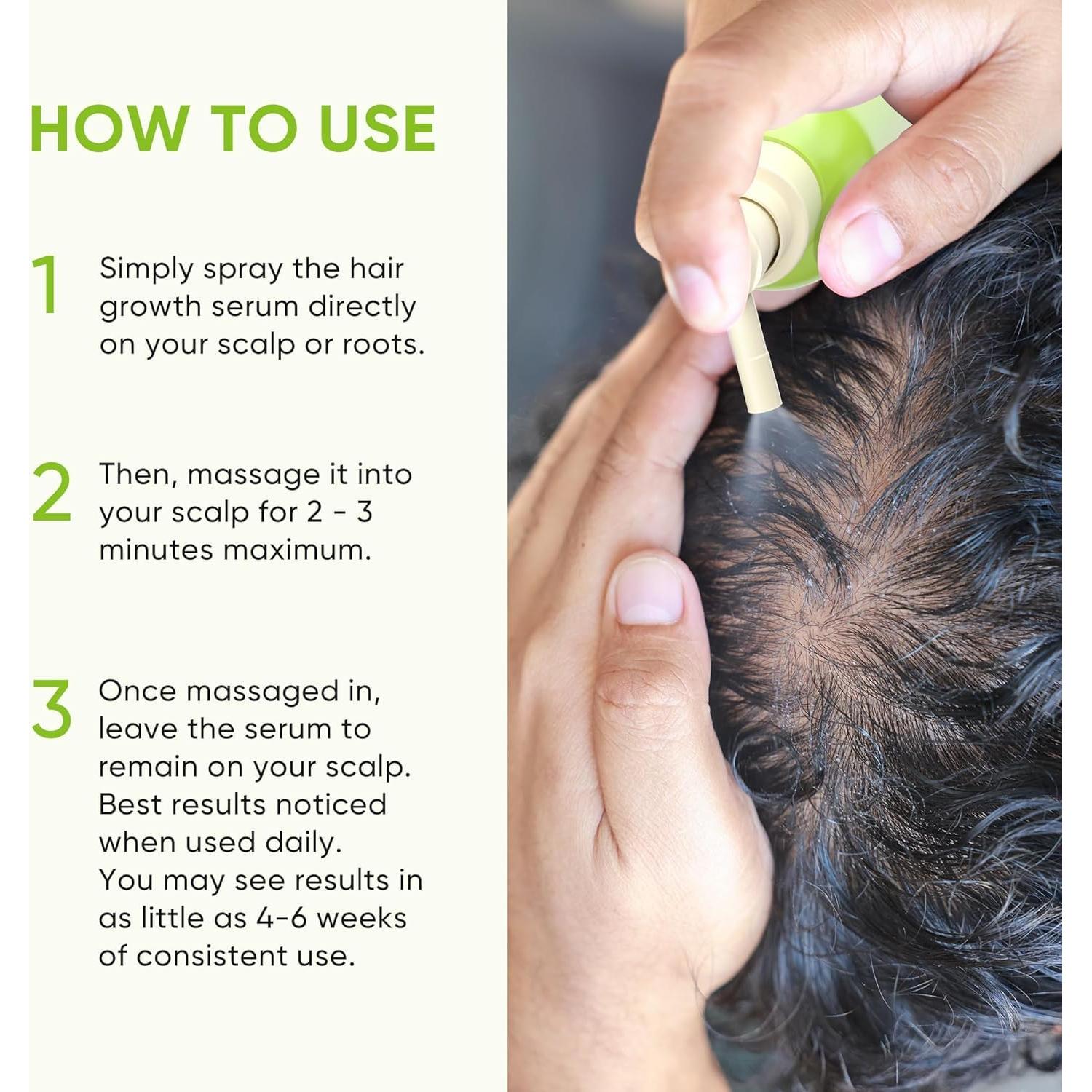 Spray Crecimiento Cabello Svvimer 59.15 ml - Romero y Biotina