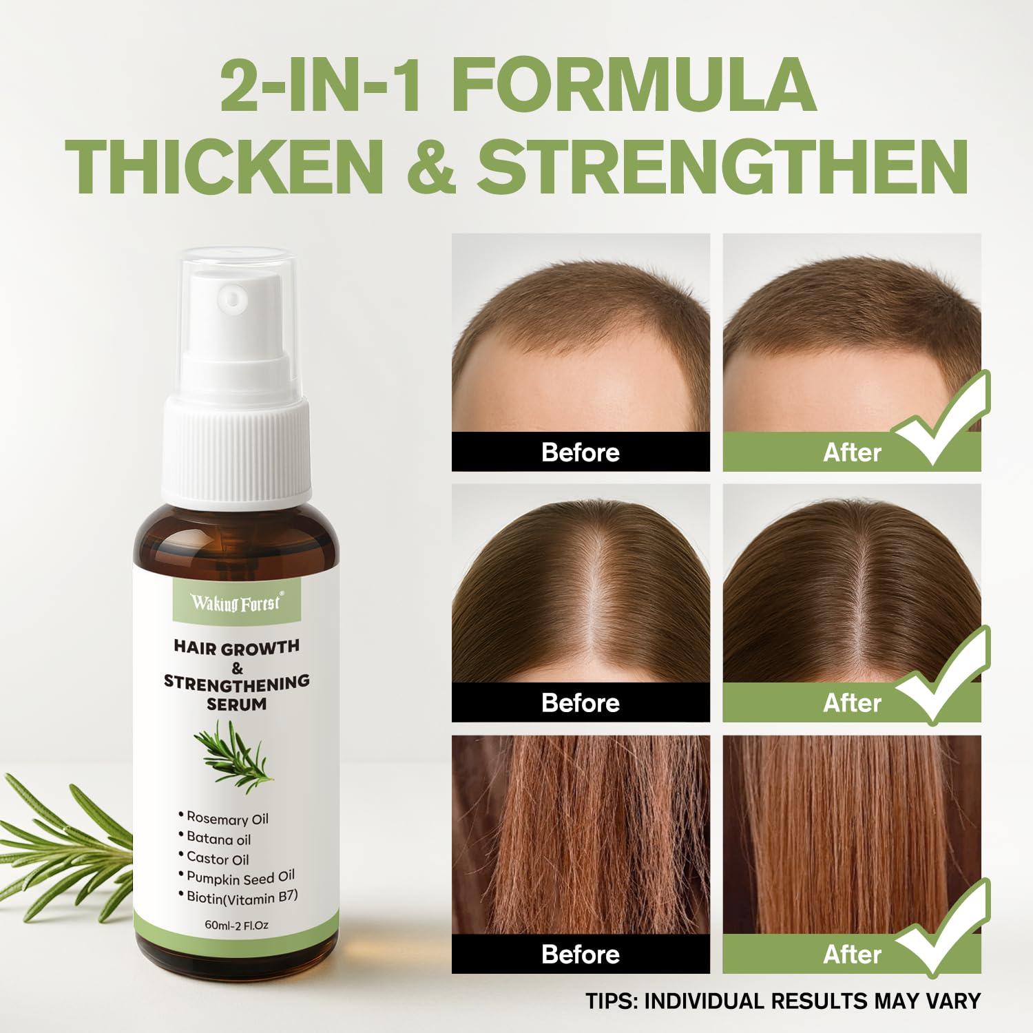 Spray Crecimiento Capilar Waking Forest 59 ml - Aceite de Romero