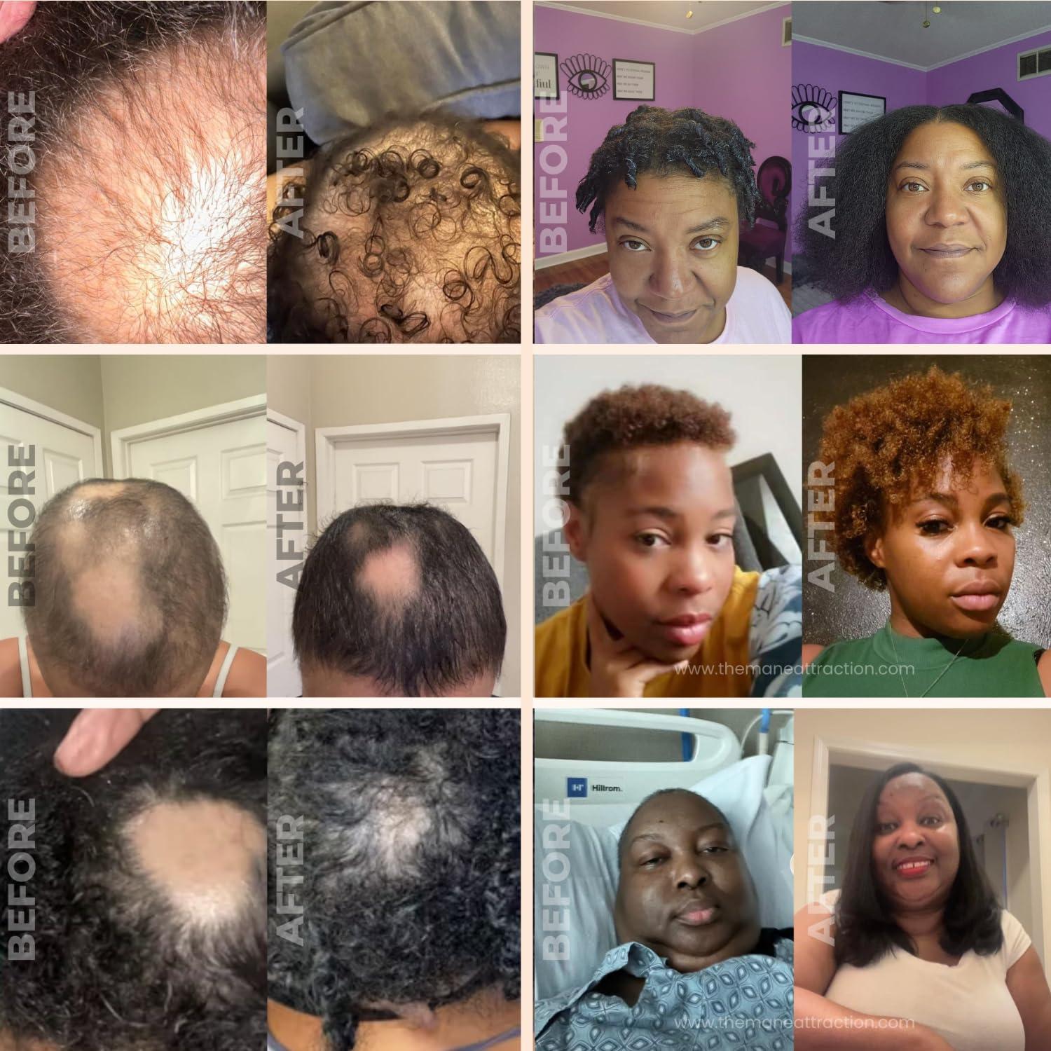 Aceite para el Cabello The Mane Attraction 118 ml - Crecimiento y Hidratación