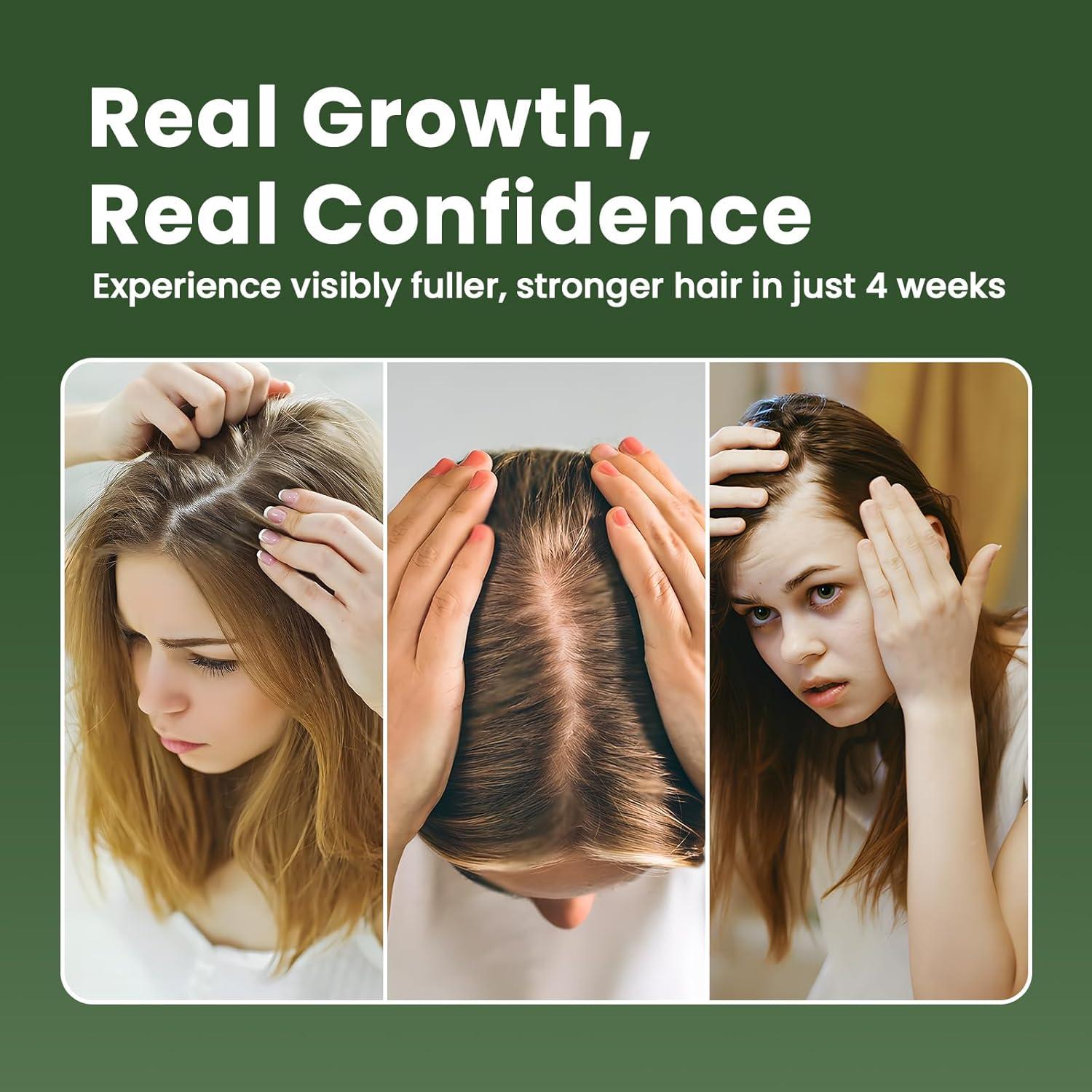 Suero Capilar Vegano con Aceite de Romero 3PCS - Crecimiento y Fortalecimiento