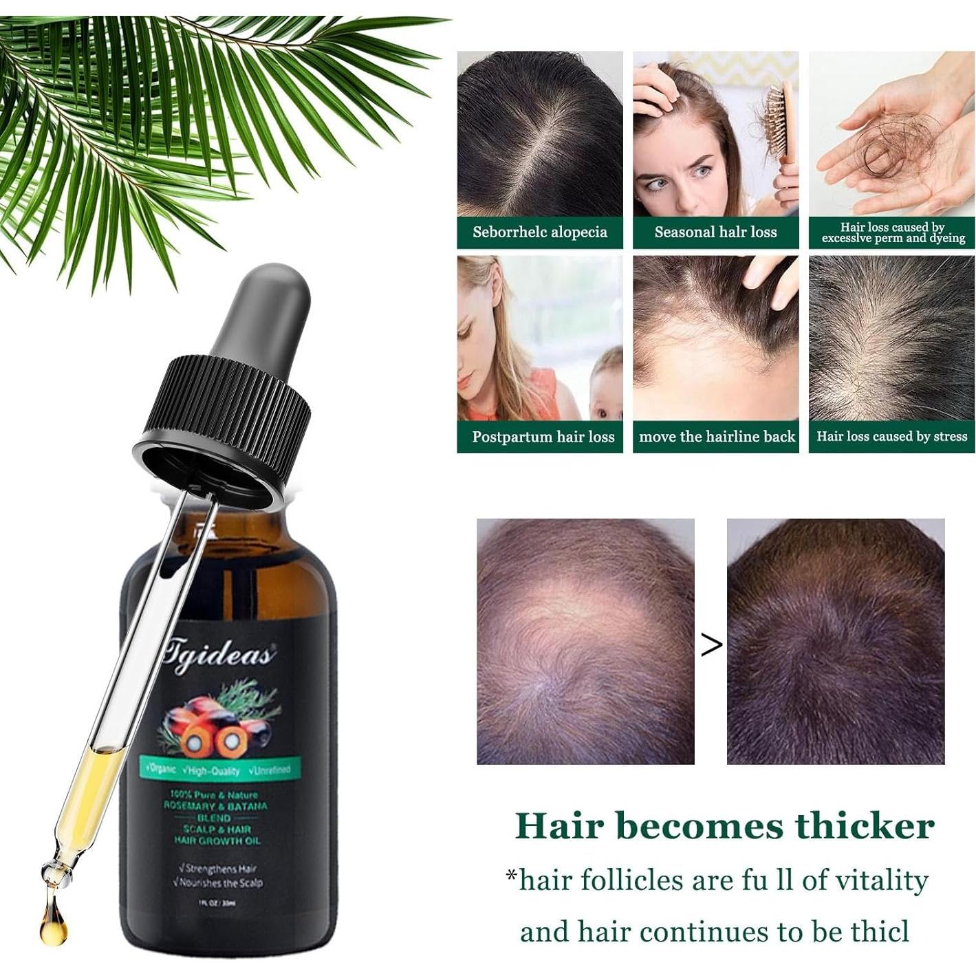 Aceite de Batana Orgánico Tgideas 29.57 ml - Crecimiento Capilar