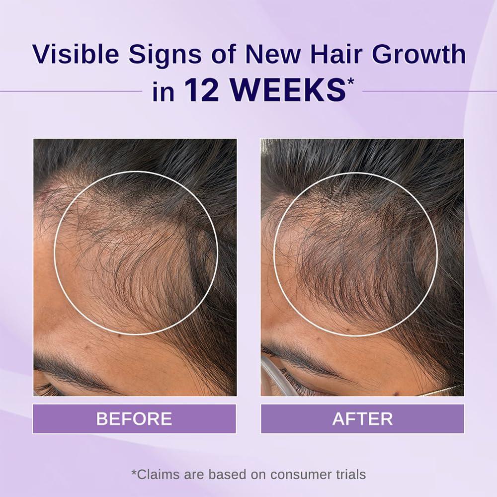 Aceite Crecimiento Capilar Bare Anatomy 100ml Romero Hibisco