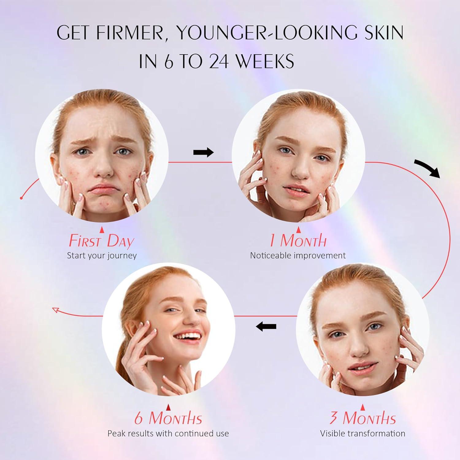 Máscara de Terapia de Luz Roja Photonstar LED Facial 660nm