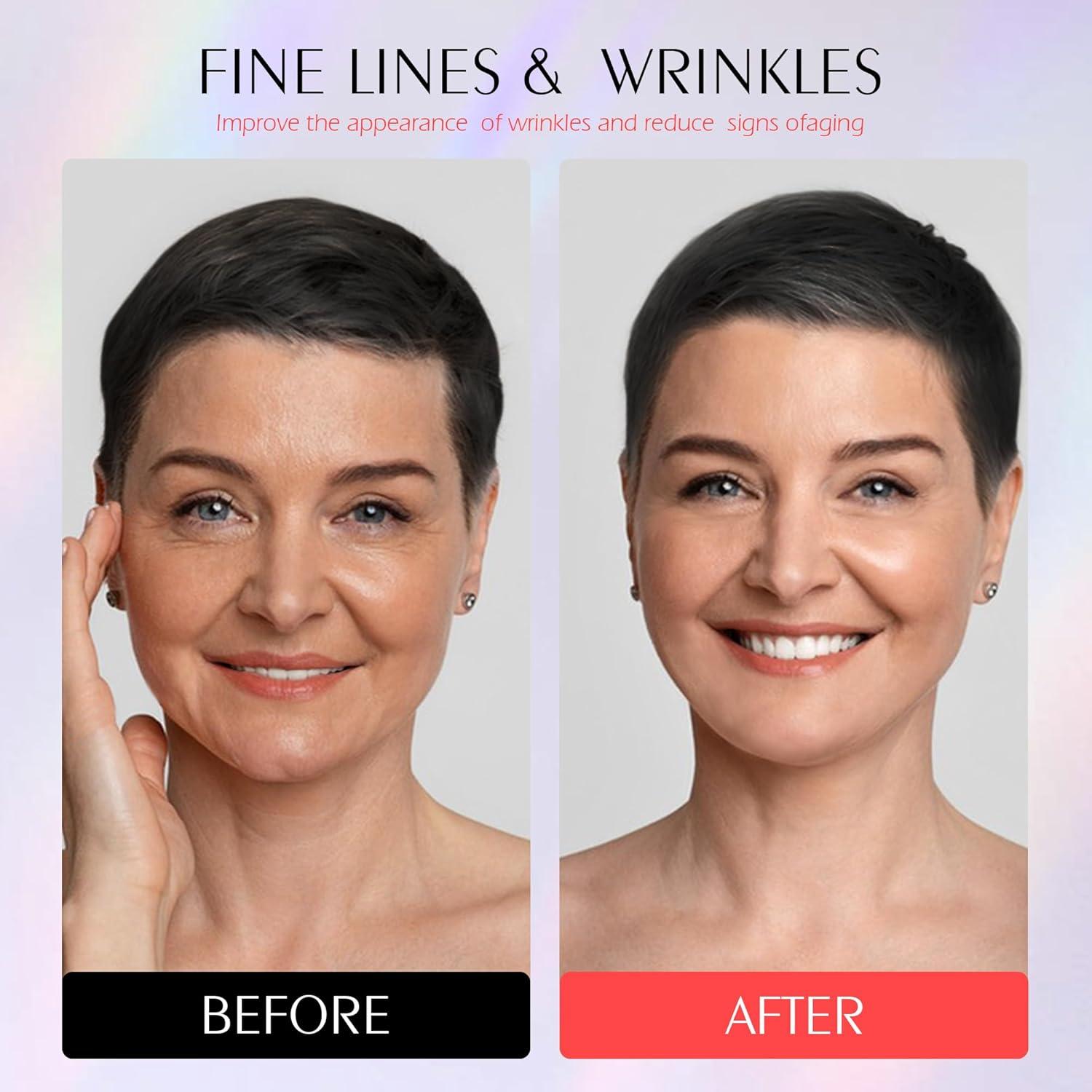 Máscara de Terapia de Luz Roja Photonstar LED Facial 660nm