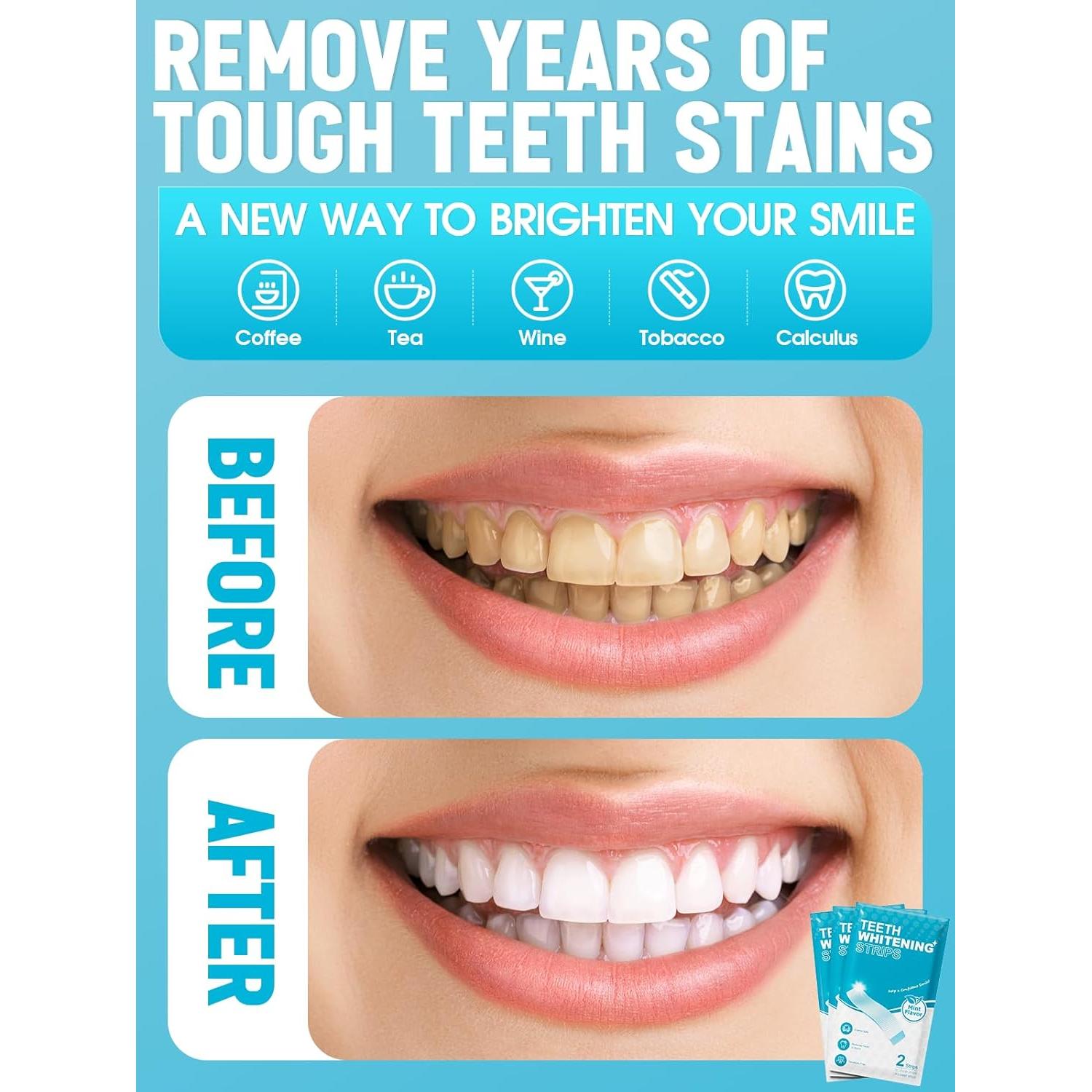 Tiras Blanqueadoras Oralfree para Dientes Sensibles - 28 Unidades