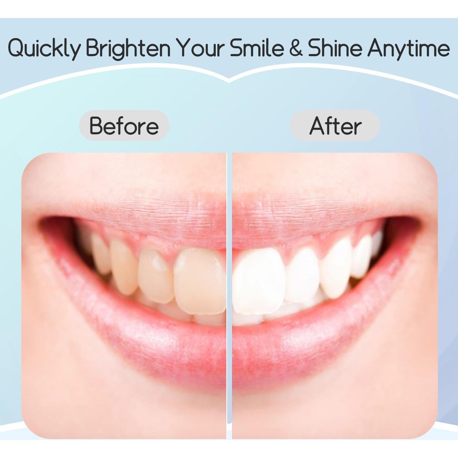 Tiras Blanqueadoras de Dientes Shodu - 14 Tratamientos Suaves