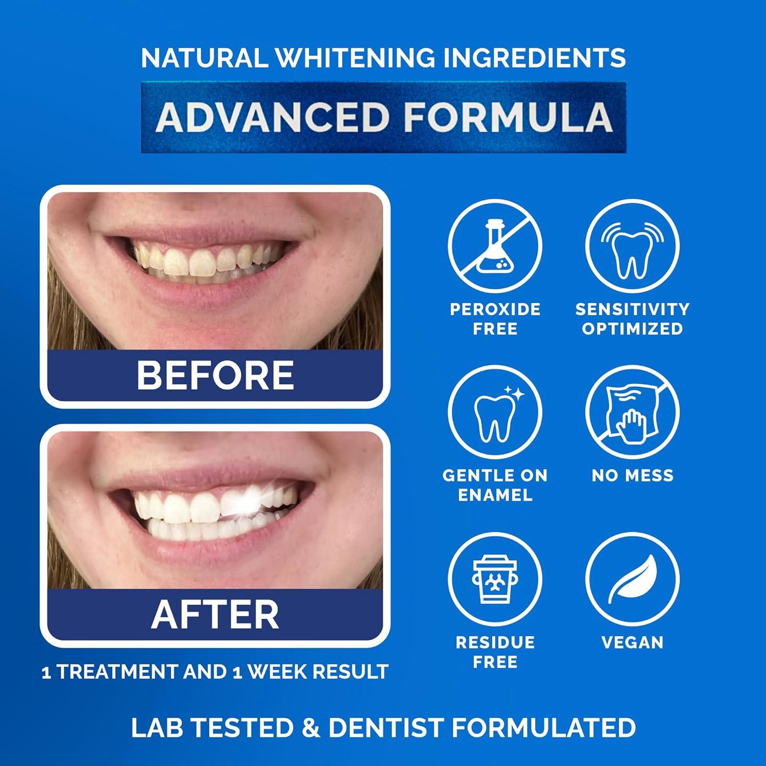 Tiras Blanqueadoras Naturales Pop On Veneers - 14 Tiras Menta