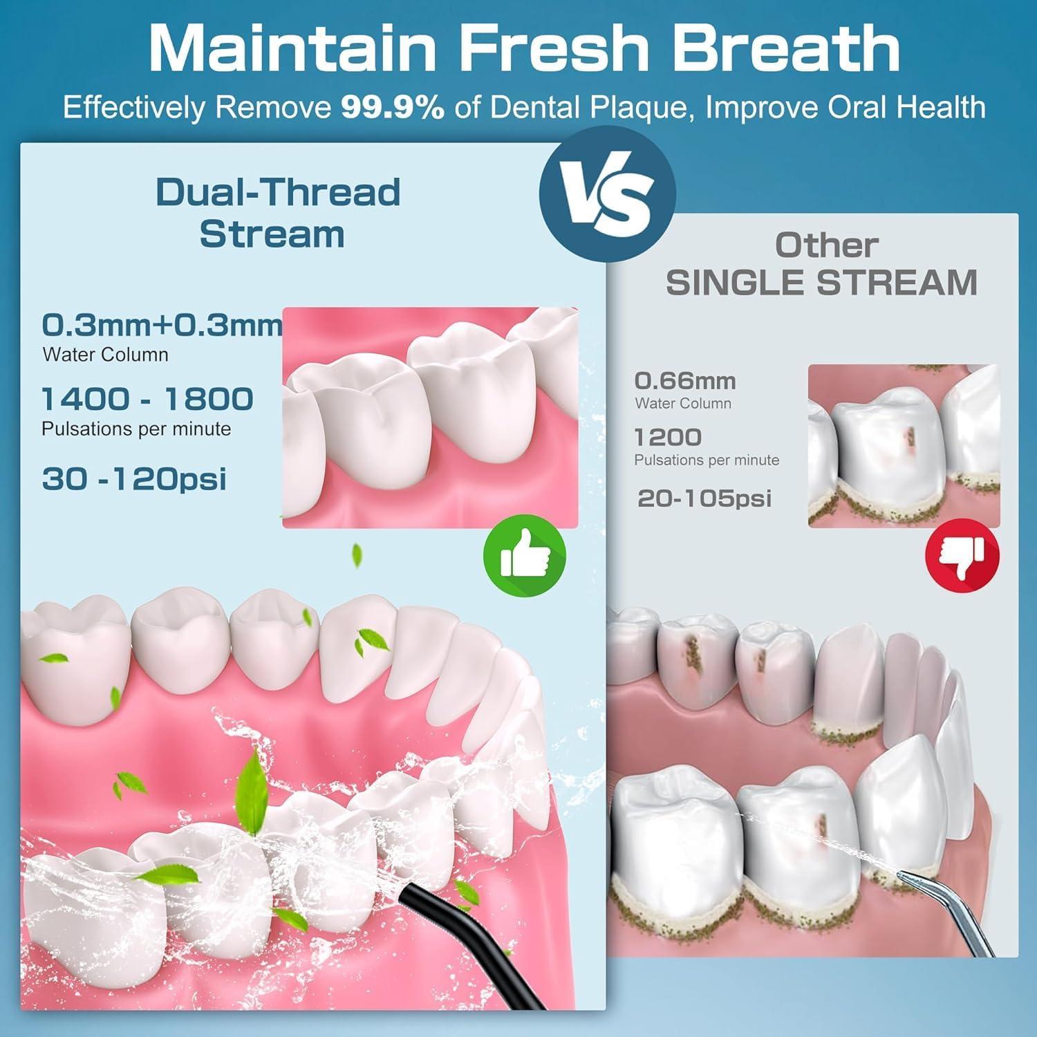 Irrigador Dental ZEXIS ZX-300 Recargable IPX7 310mL 6 Puntas