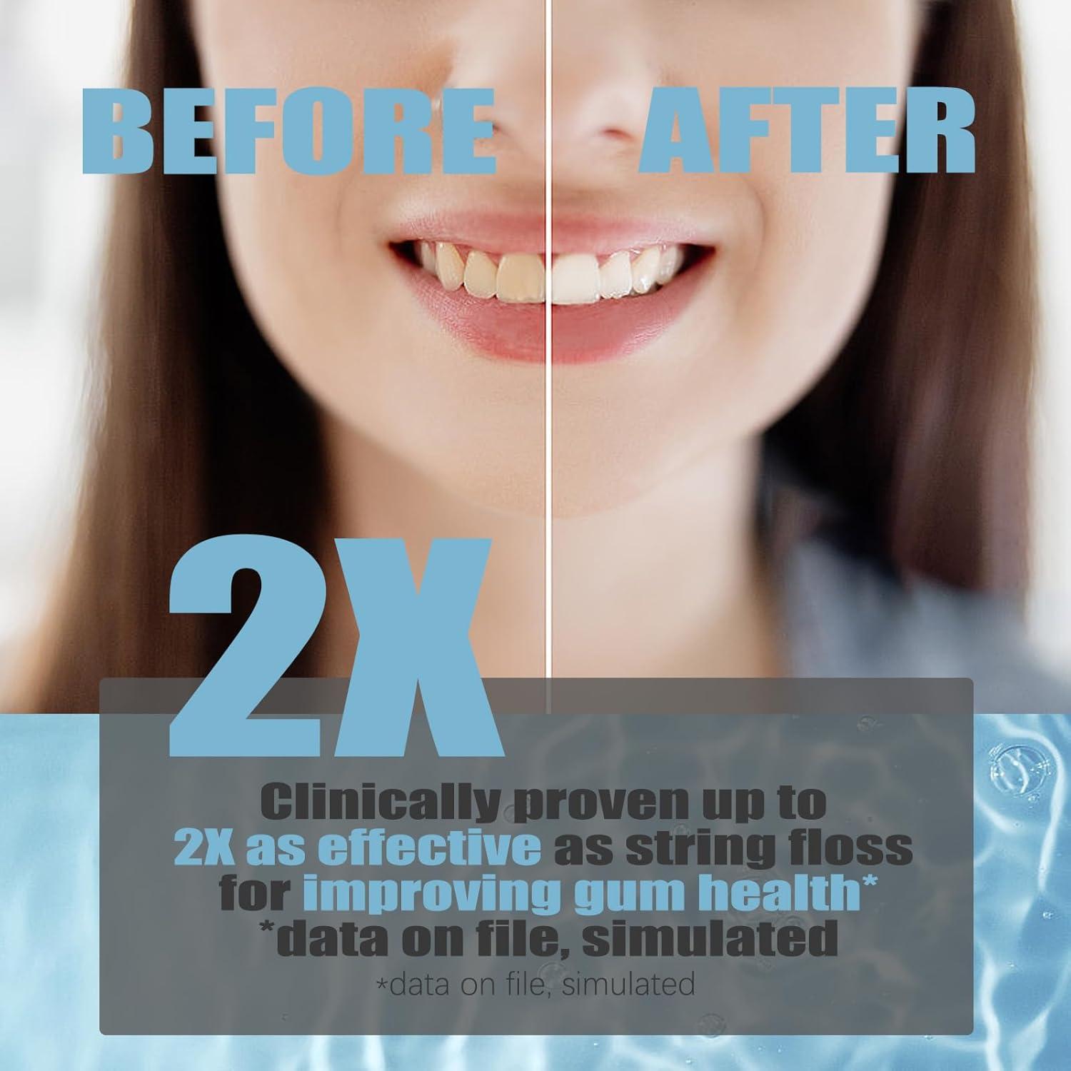 Hilo Dental Inalámbrico ZQ A16 Recargable 300ML 4 Boquillas IPX7