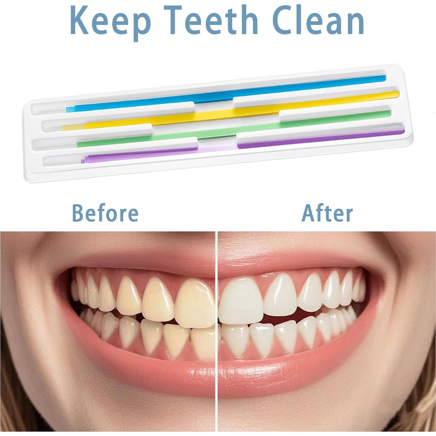 Kit de Tiras de Pulido Dental DANTICY 80 Piezas 15.24 cm