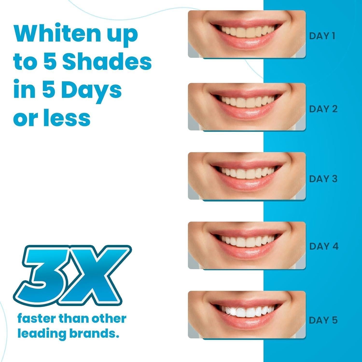 Tiras de Blanqueamiento Dental Lumist - 10 Unidades - Sabor Menta