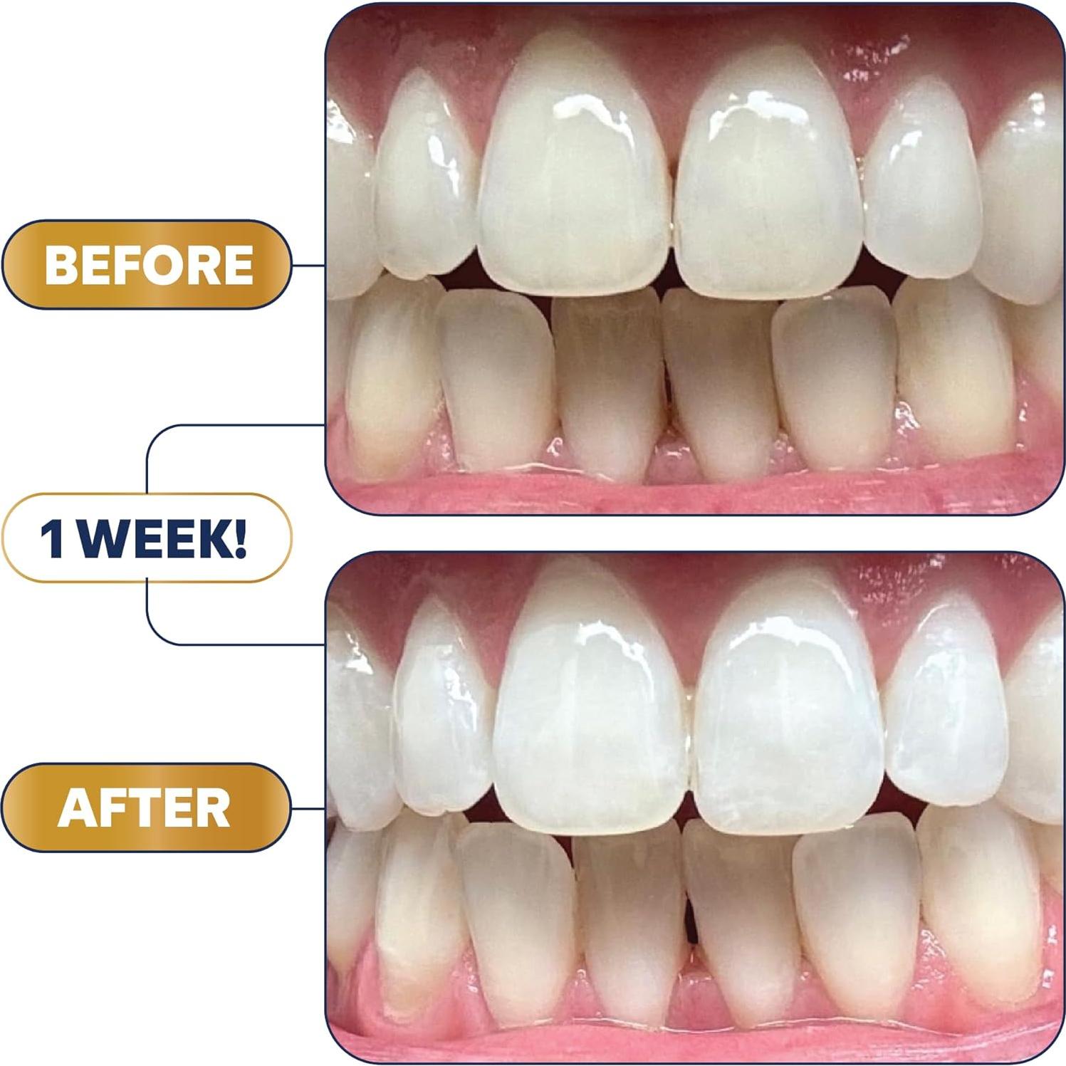 Kit de Blanqueamiento Dental Lumineux - Pasta, Enjuague y Tiras