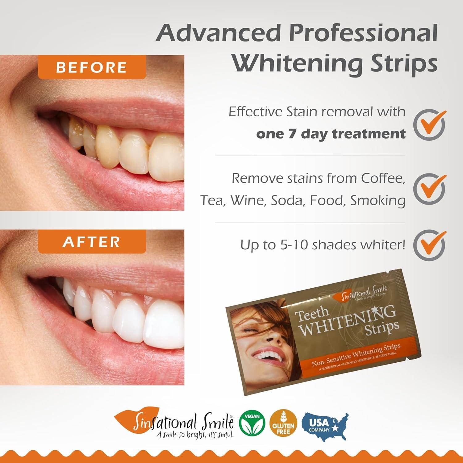 Tiras Blanqueadoras Sinsational Smile - 28 Tiras (14 Tratamientos) para Dientes Sensibles