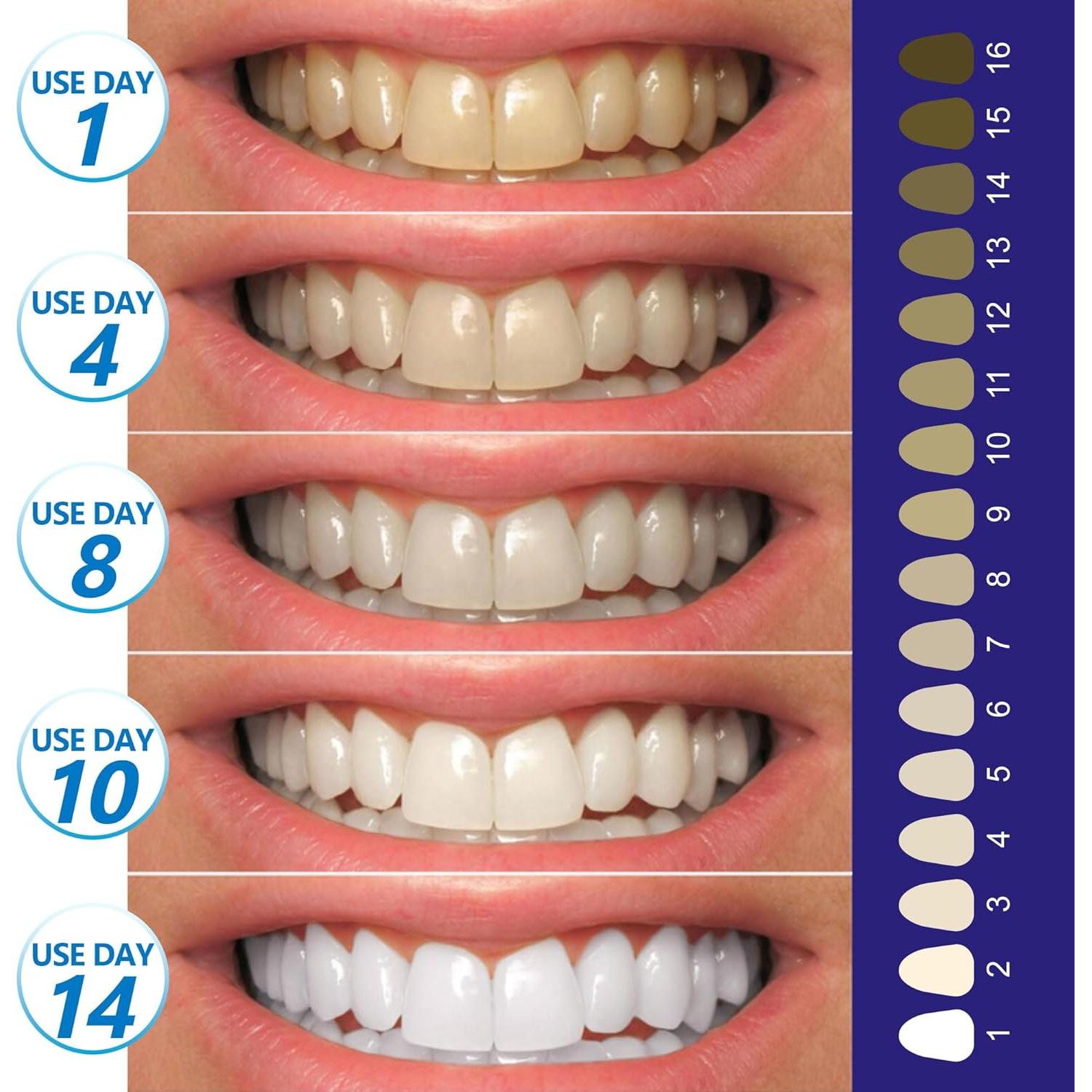 Tiras Blanqueadoras de Dientes Spearlcable - 28 Tiras, Sin Peróxido