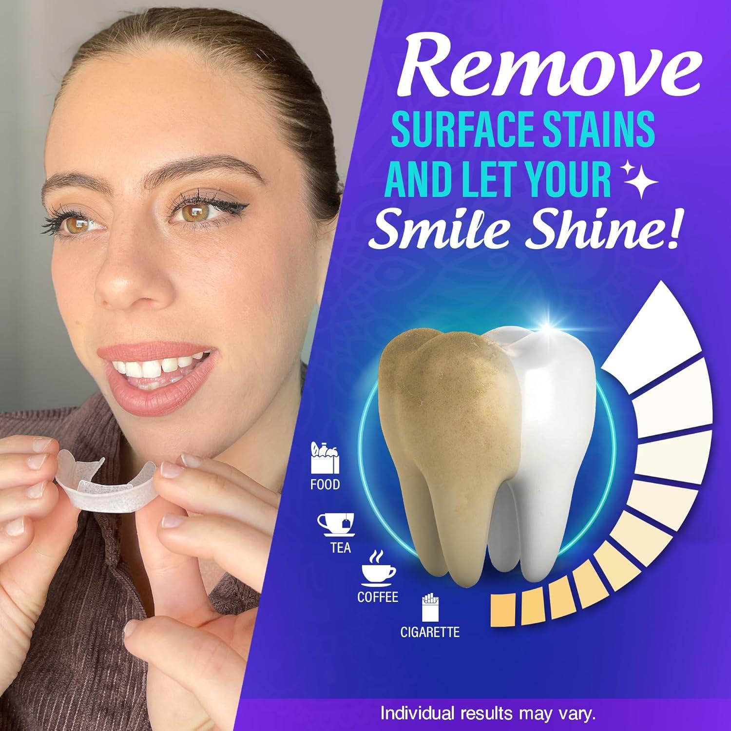 Bandejas de Blanqueamiento Dental GuruNanda 8% Peróxido 7 Tratamientos