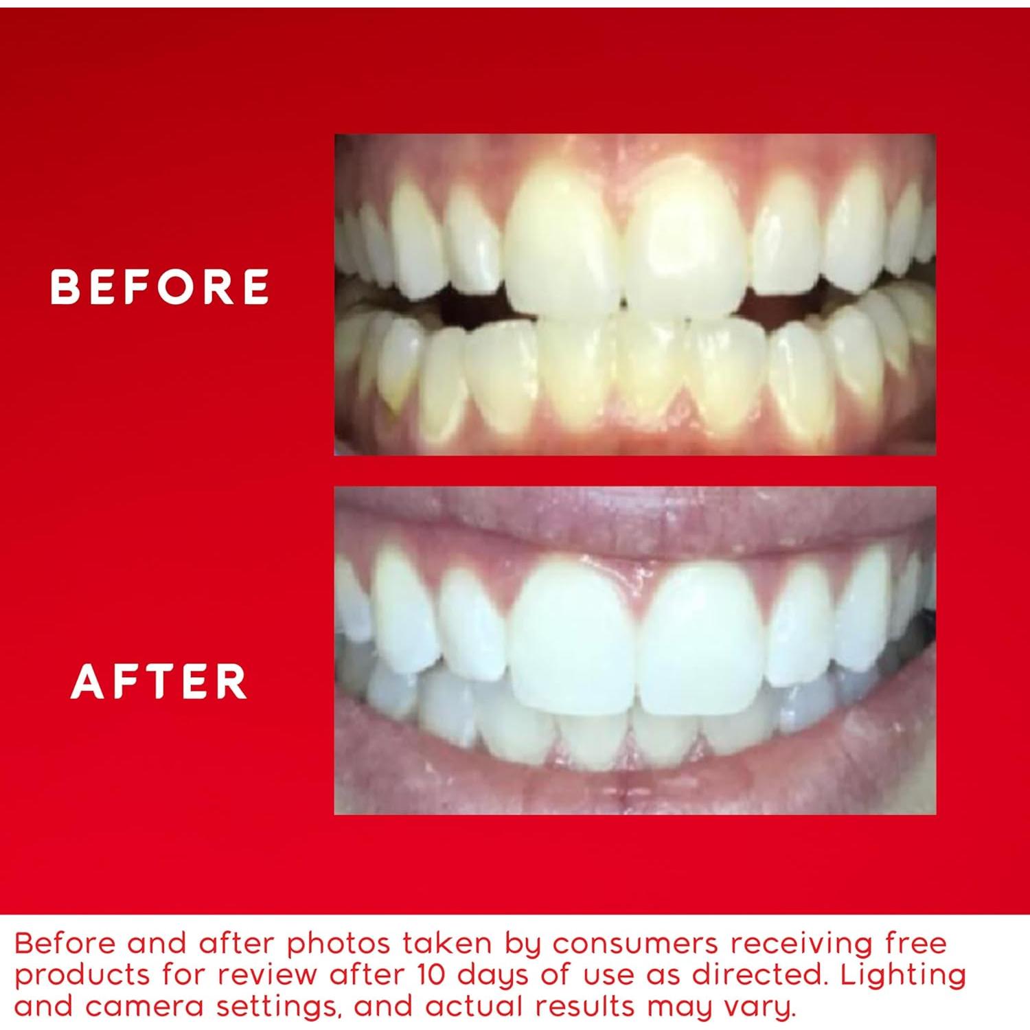 Kit Blanqueamiento Dental Colgate Optic White LED 21 Tratamientos