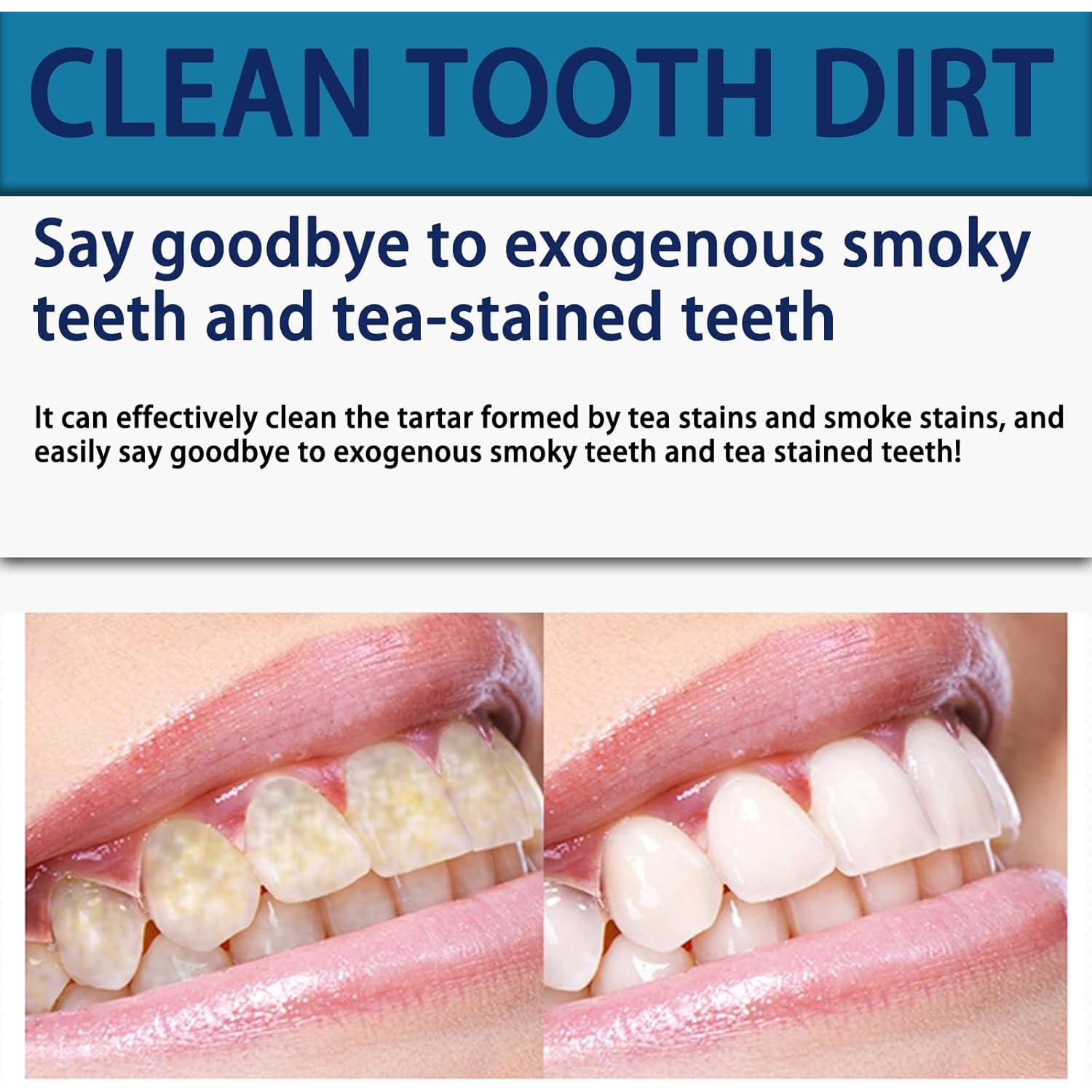 Tiras Blanqueadoras de Dientes ABYST 44 Ct Cuidado Dental Suave