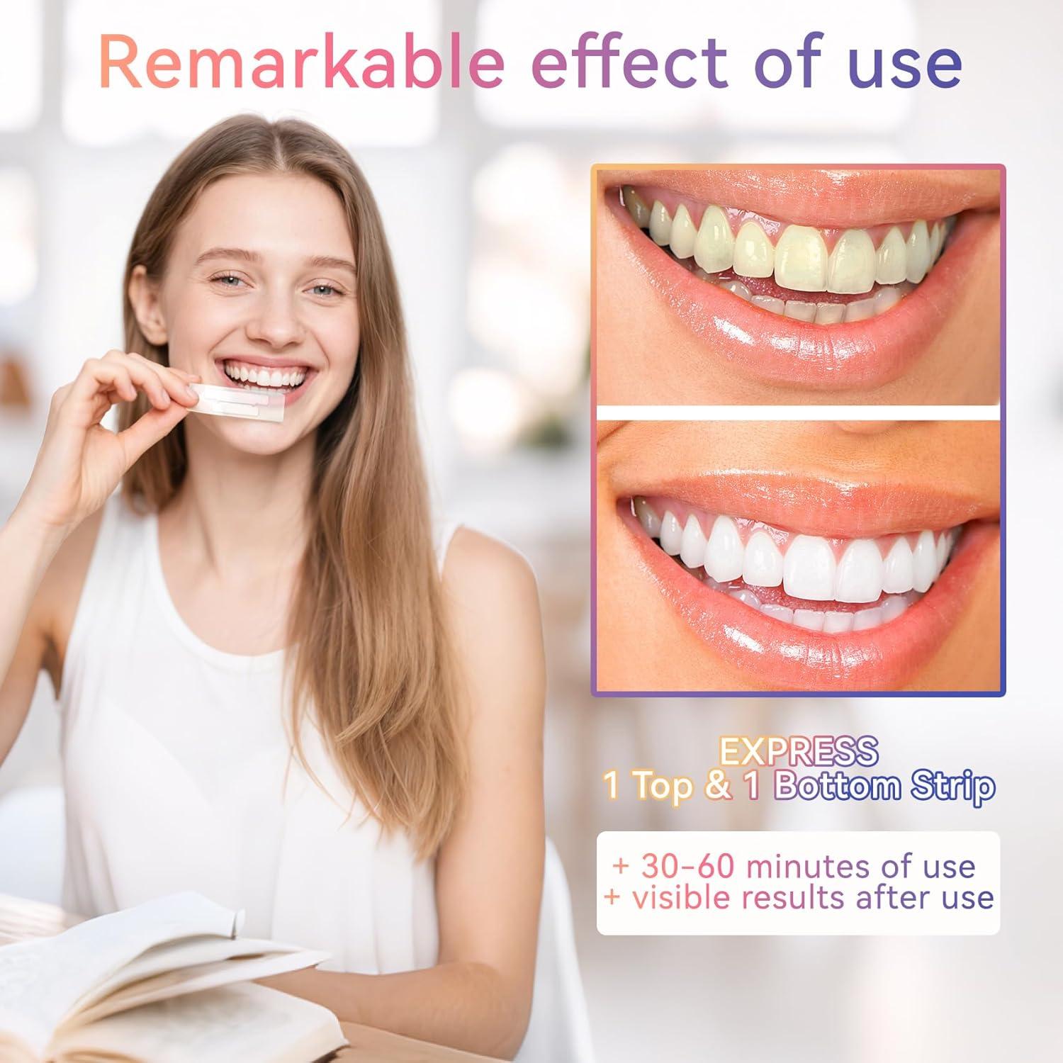 Tiras Blanqueadoras QICCJXYX para Dientes Sensibles - 28PCS