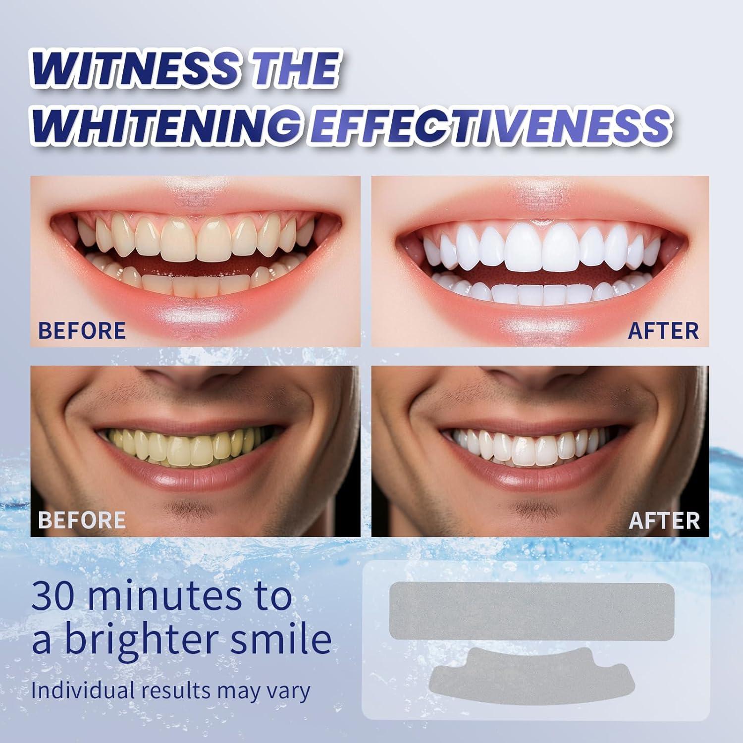 Tiras Blanqueadoras de Dientes Lanlwos 28 Unidades Sin Peróxido