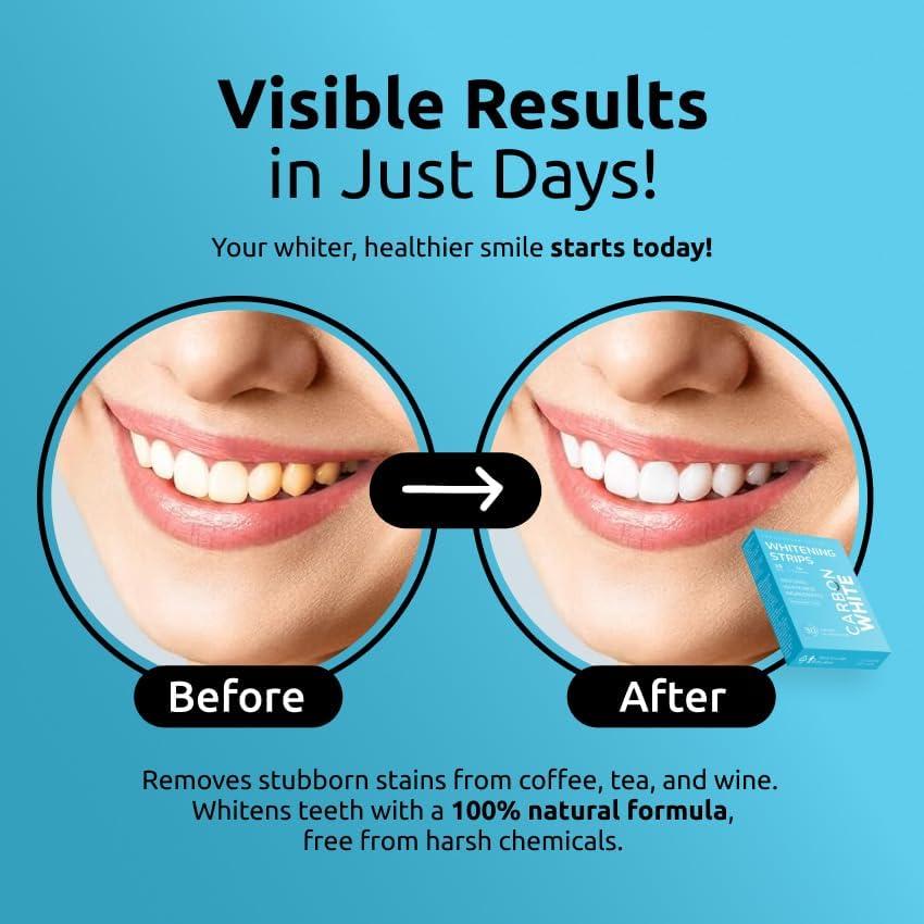 Tiras Blanqueadoras de Dientes Carbon White - 28 Unidades - Sabor Menta