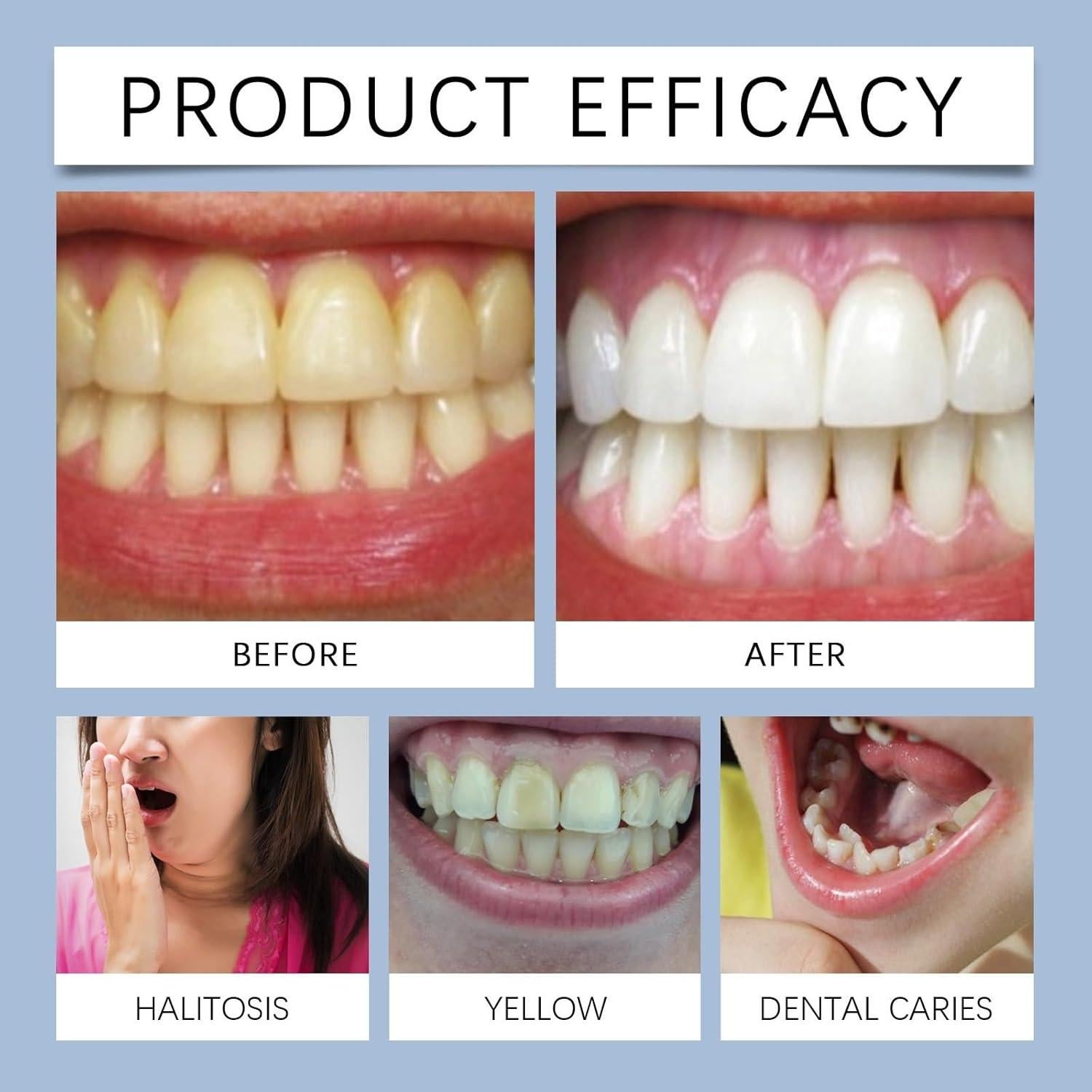 Kit de Tiras Blanqueadoras Piegricdiat - Antideslizantes 11.7cm