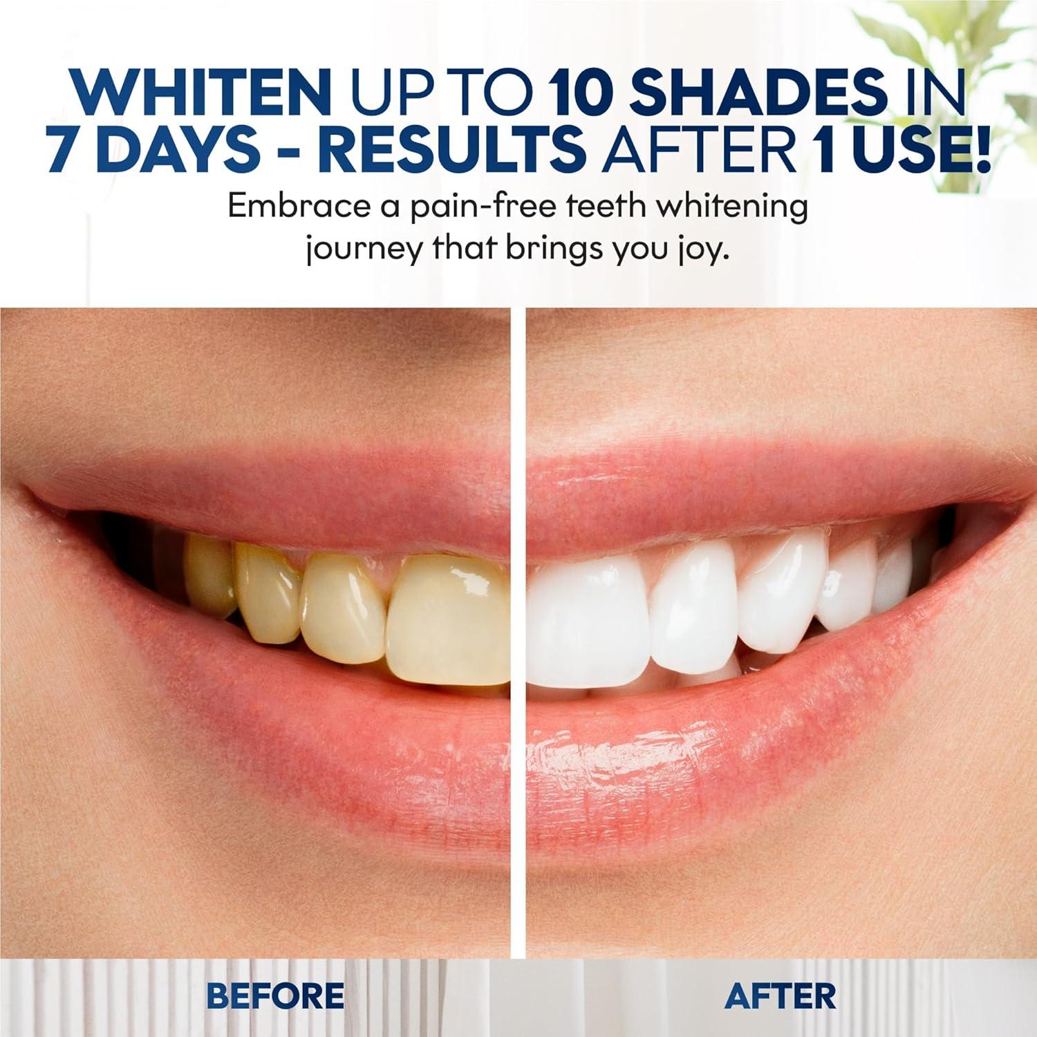 Tiras Blanqueadoras de Dientes ChloeC | 7 Tratamientos Menta