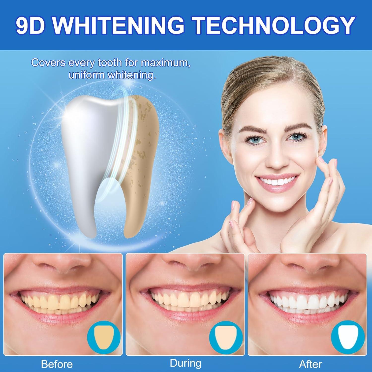 Kit de Tiras Blanqueadoras Ruduwu para Dientes Sensibles - 28 Tiras