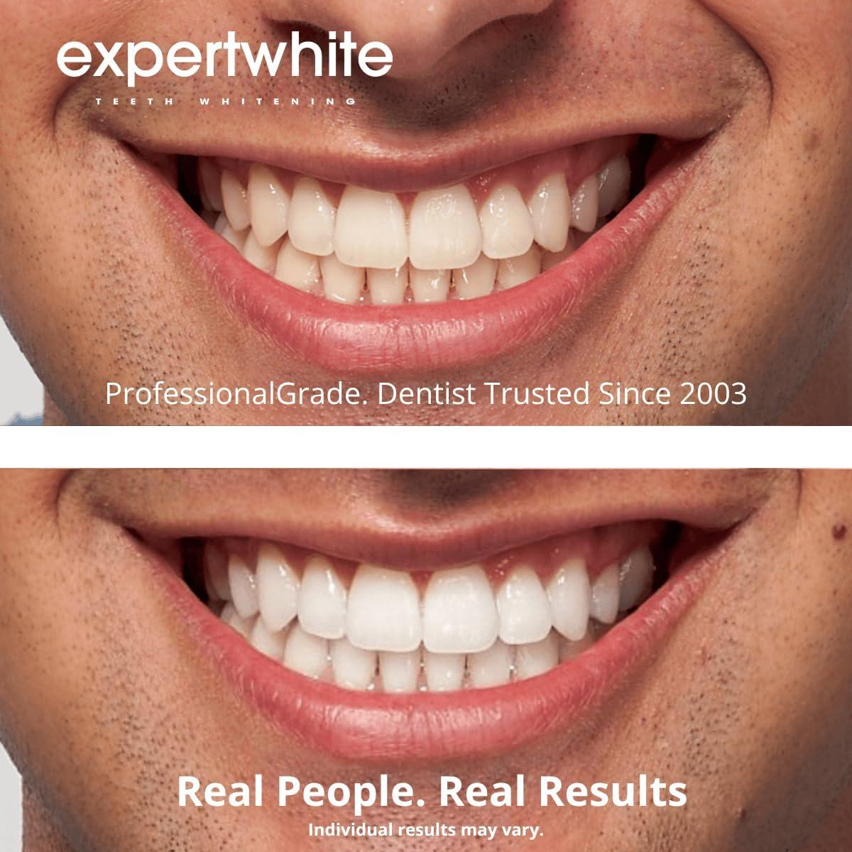 Tiras de Blanqueamiento Dental Expertwhite Max+ - 28 Tiras