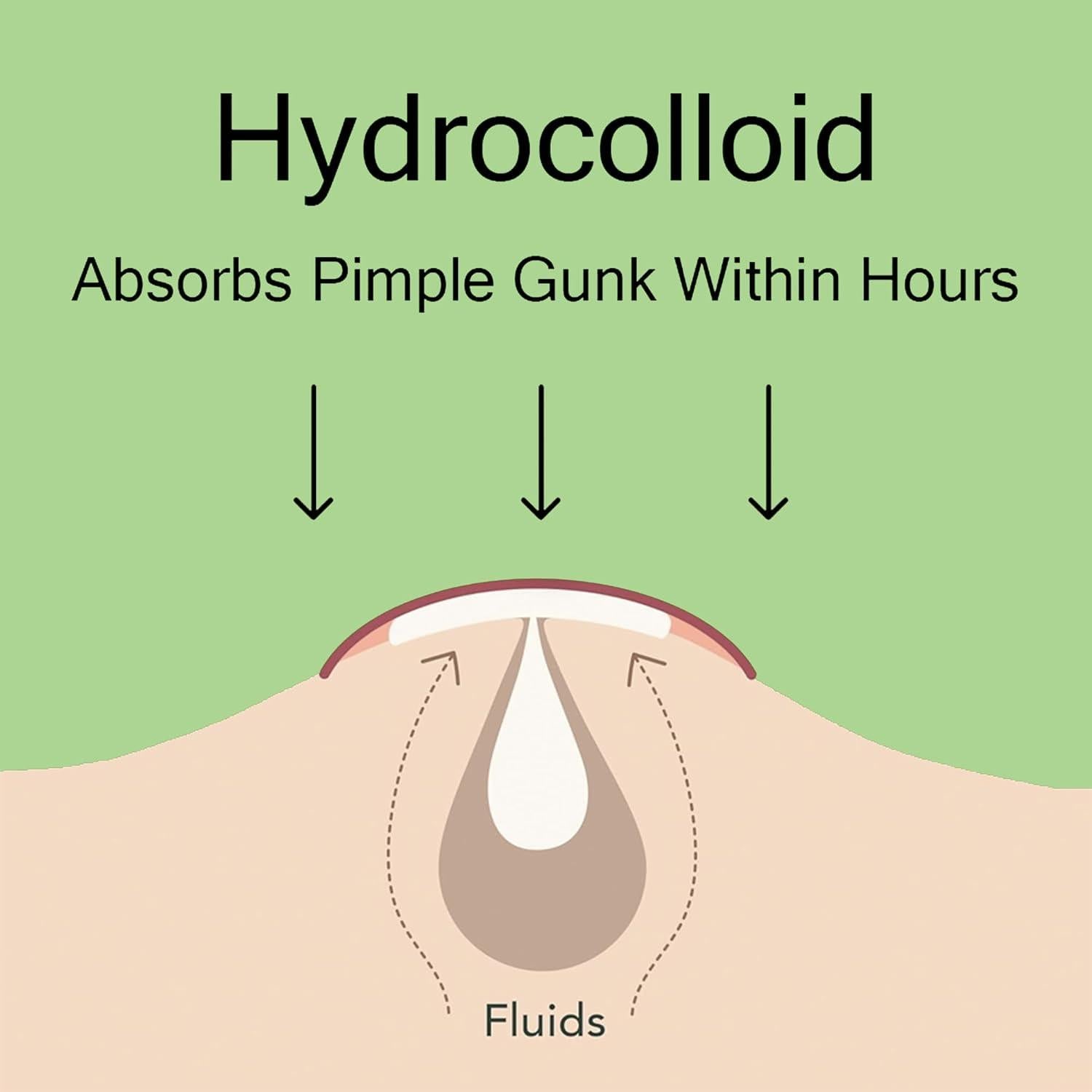 Parche para Acné FlexPharm - 72 Unidades Hidrocoloide 8mm y 10mm