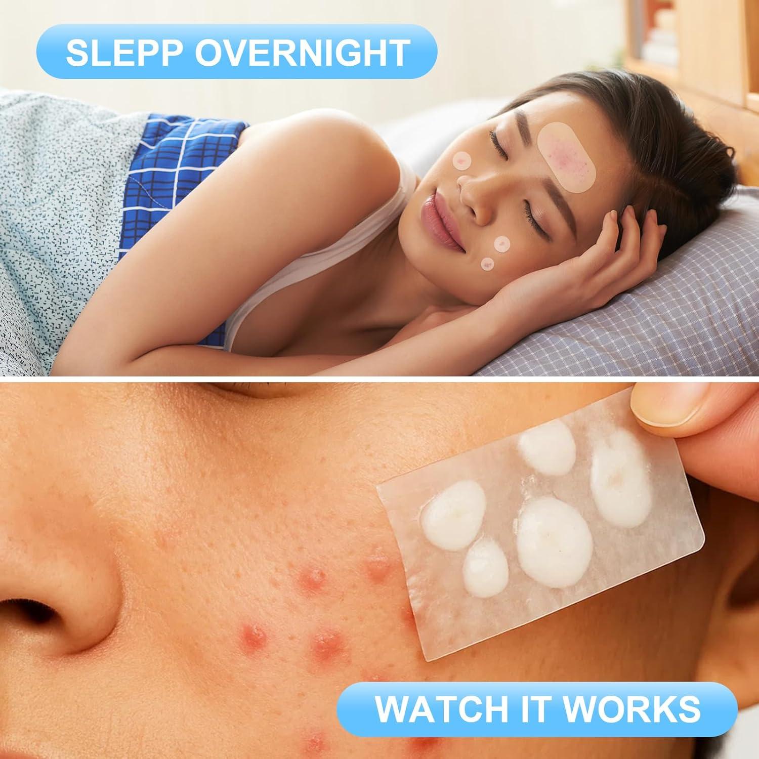 Parches Hidrocoloides AUSLKA para Espinillas - 500 Parches