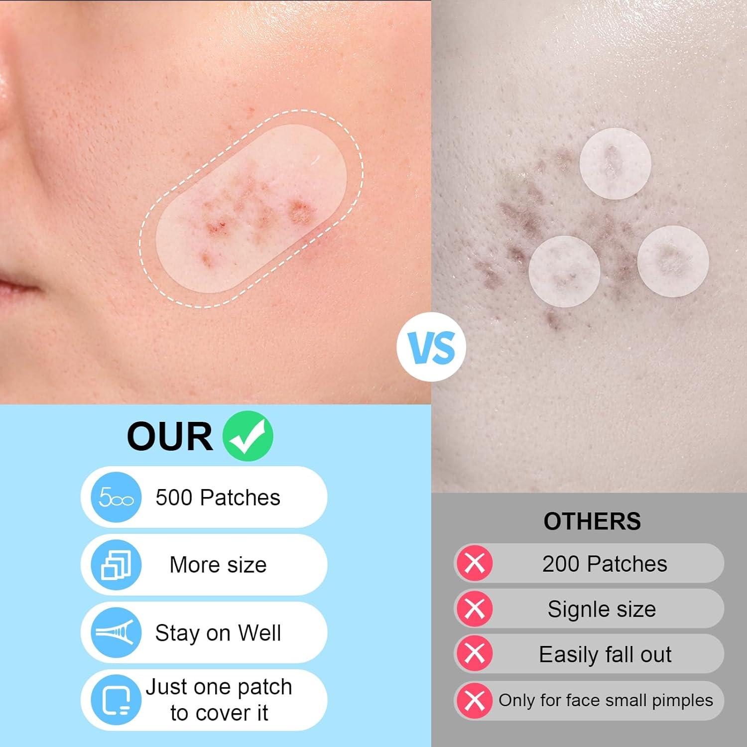 Parches Hidrocoloides AUSLKA para Espinillas - 500 Parches