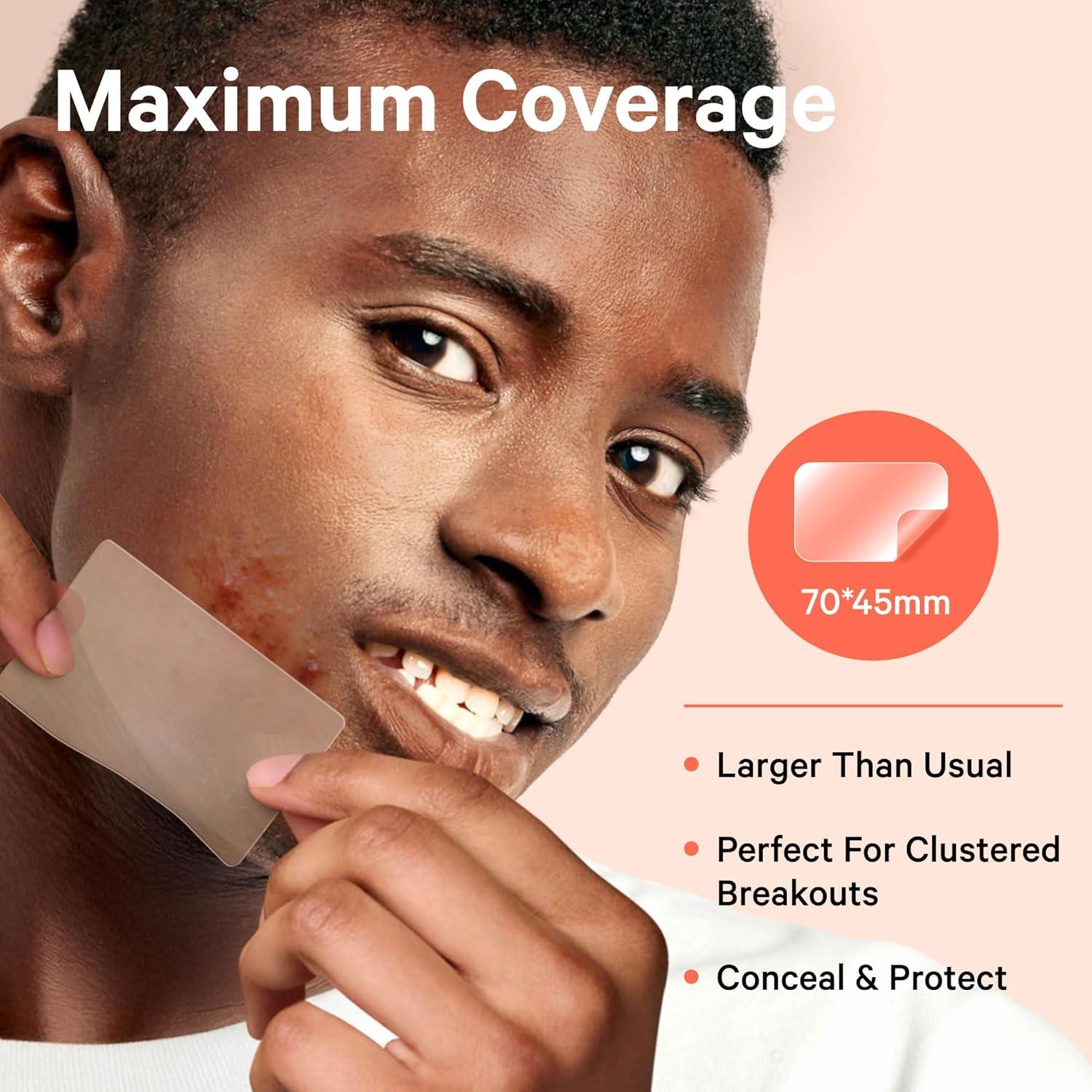 Parches para Granos Grandes Sosky XL Hidrocoloide Vegano 8 Unidades