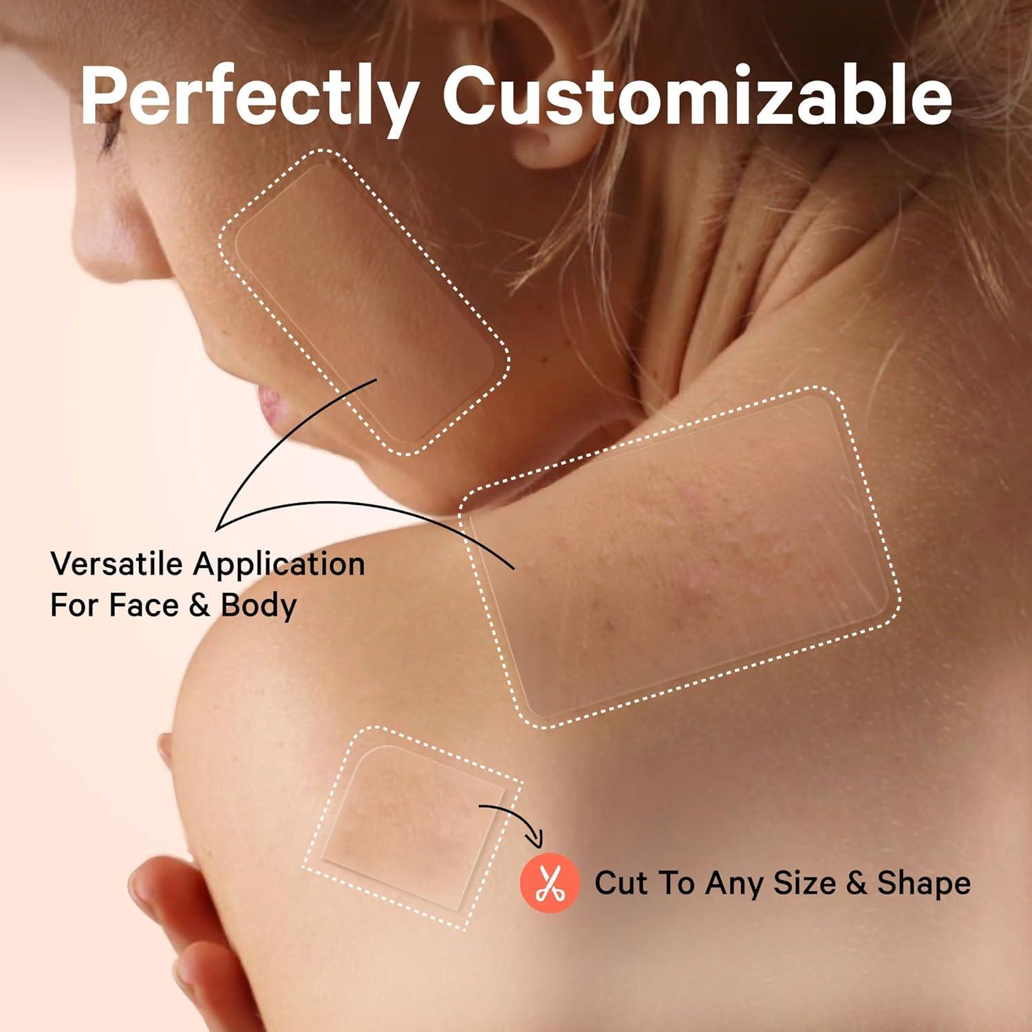 Parches para Granos Grandes Sosky XL Hidrocoloide Vegano 8 Unidades