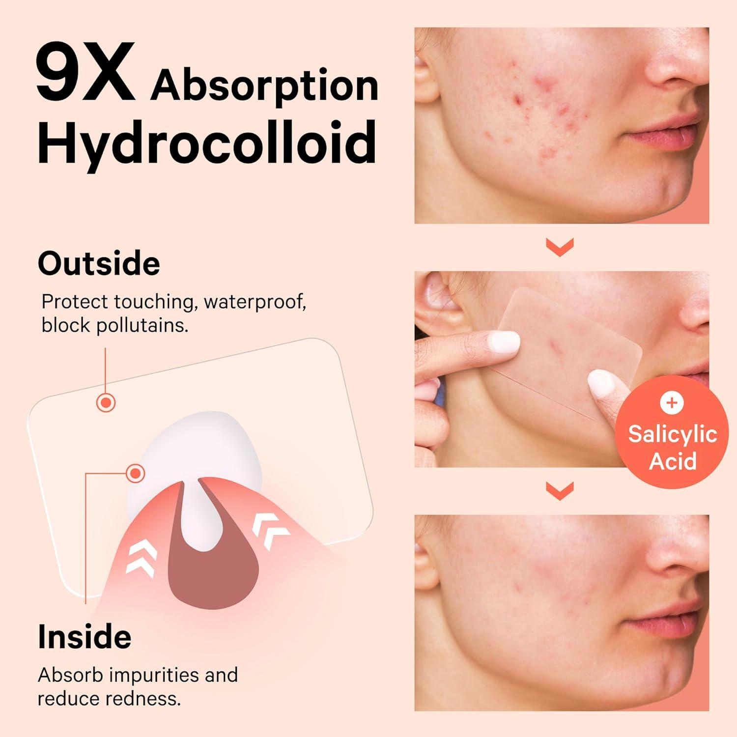 Parches para Granos Grandes Sosky XL Hidrocoloide Vegano 8 Unidades