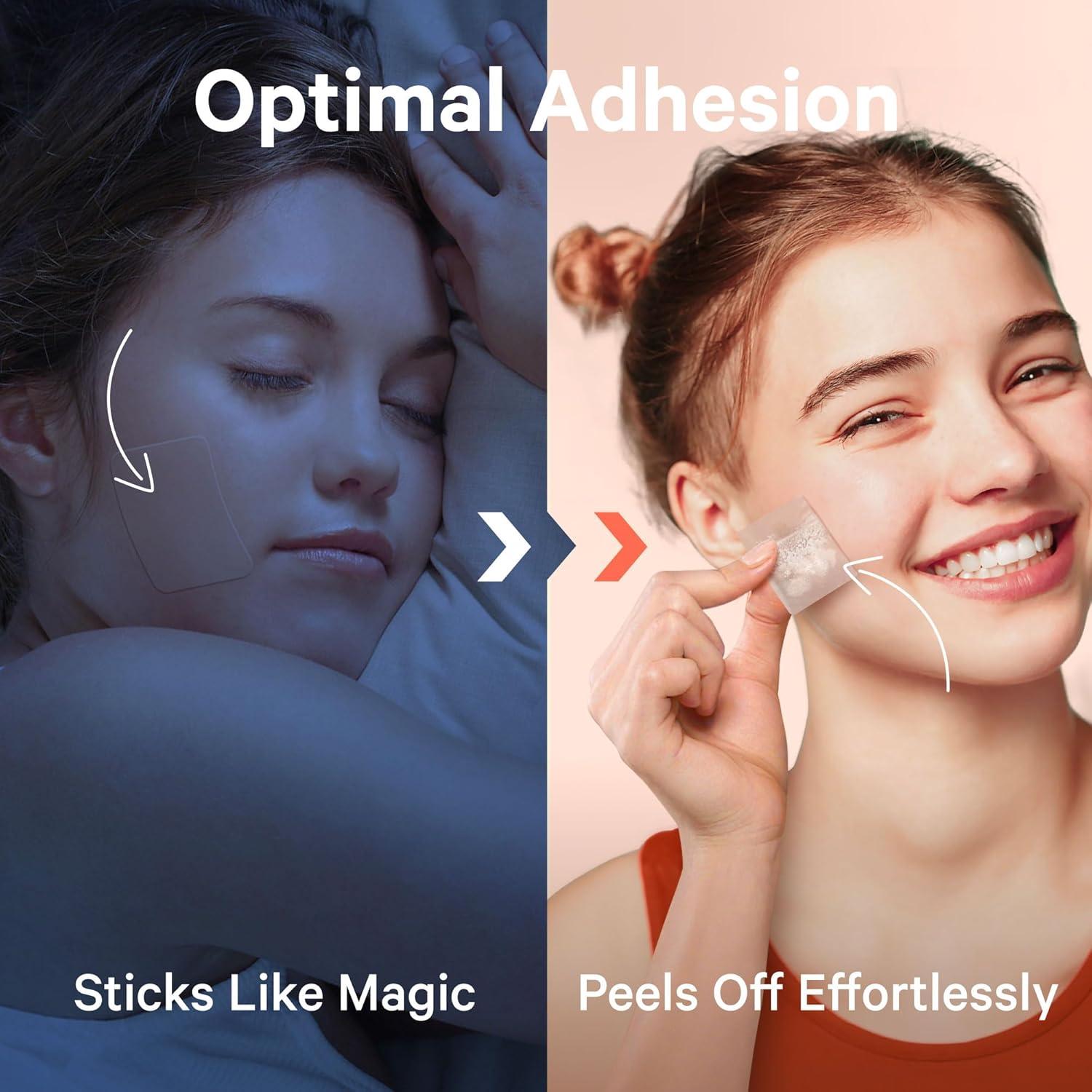 Parches para Granos Grandes Sosky XL Hidrocoloide Vegano 8 Unidades