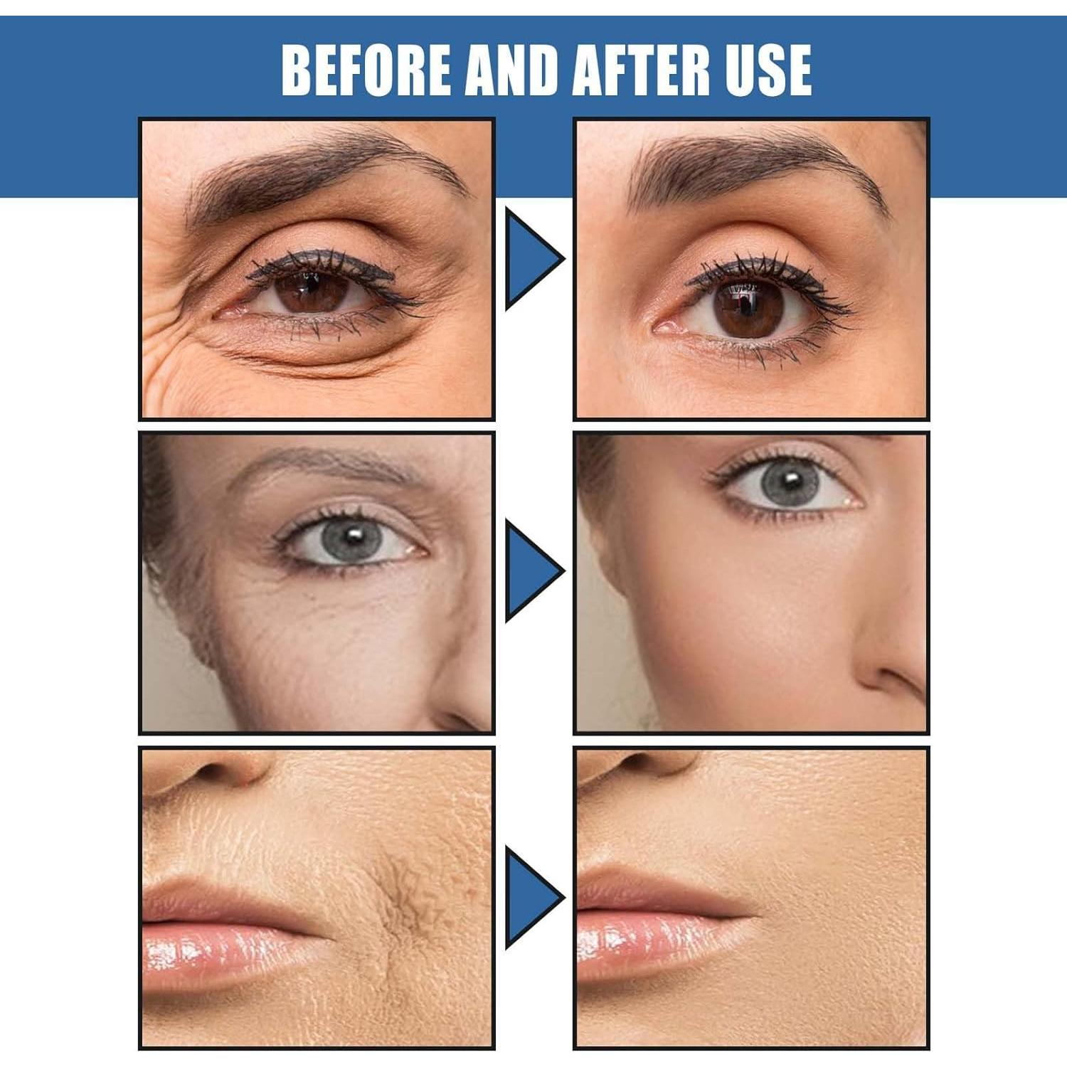 Crema Facial Antiarrugas Getzan 30ml con Retinol Hidratante