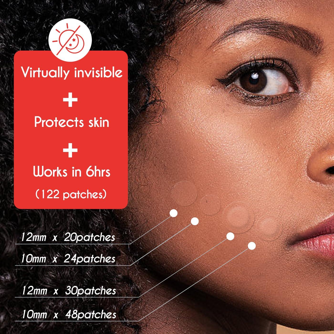 Parche Hidrocoloide para Granos ZHAOLIESM - 122 Unidades