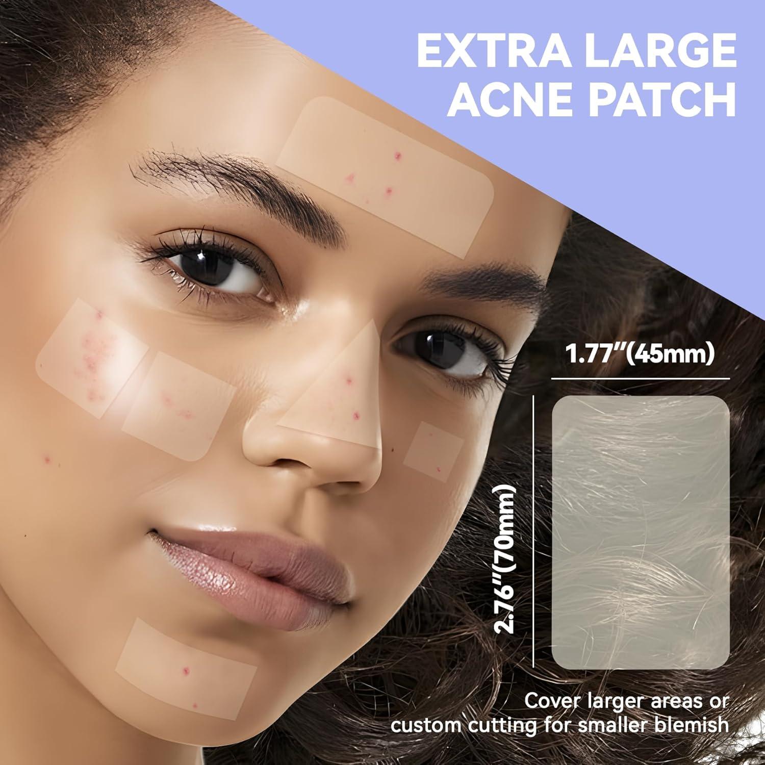 Parches para Granos Dazzlook XL - 8 Unidades con Ácido Salicílico