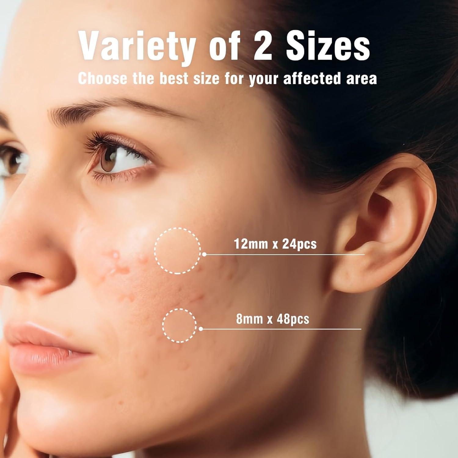 Parches Hidrocoloides OUKEYA para Granitos - 36 Unidades