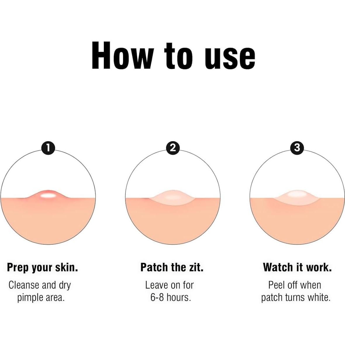 Parches Hidrocoloides OUKEYA para Granitos - 36 Unidades